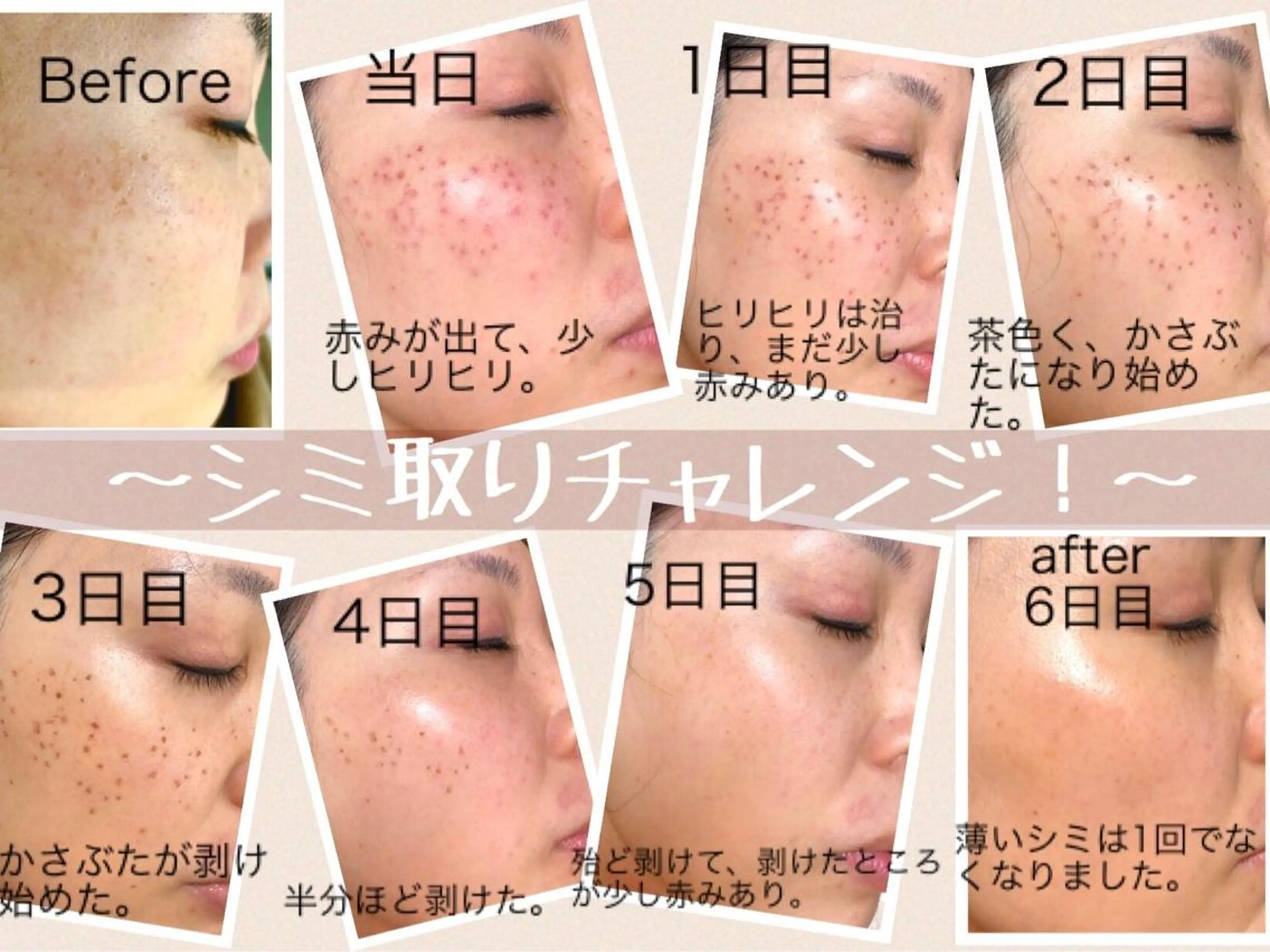 Labelta 遠田のエステ・リラクイメージ