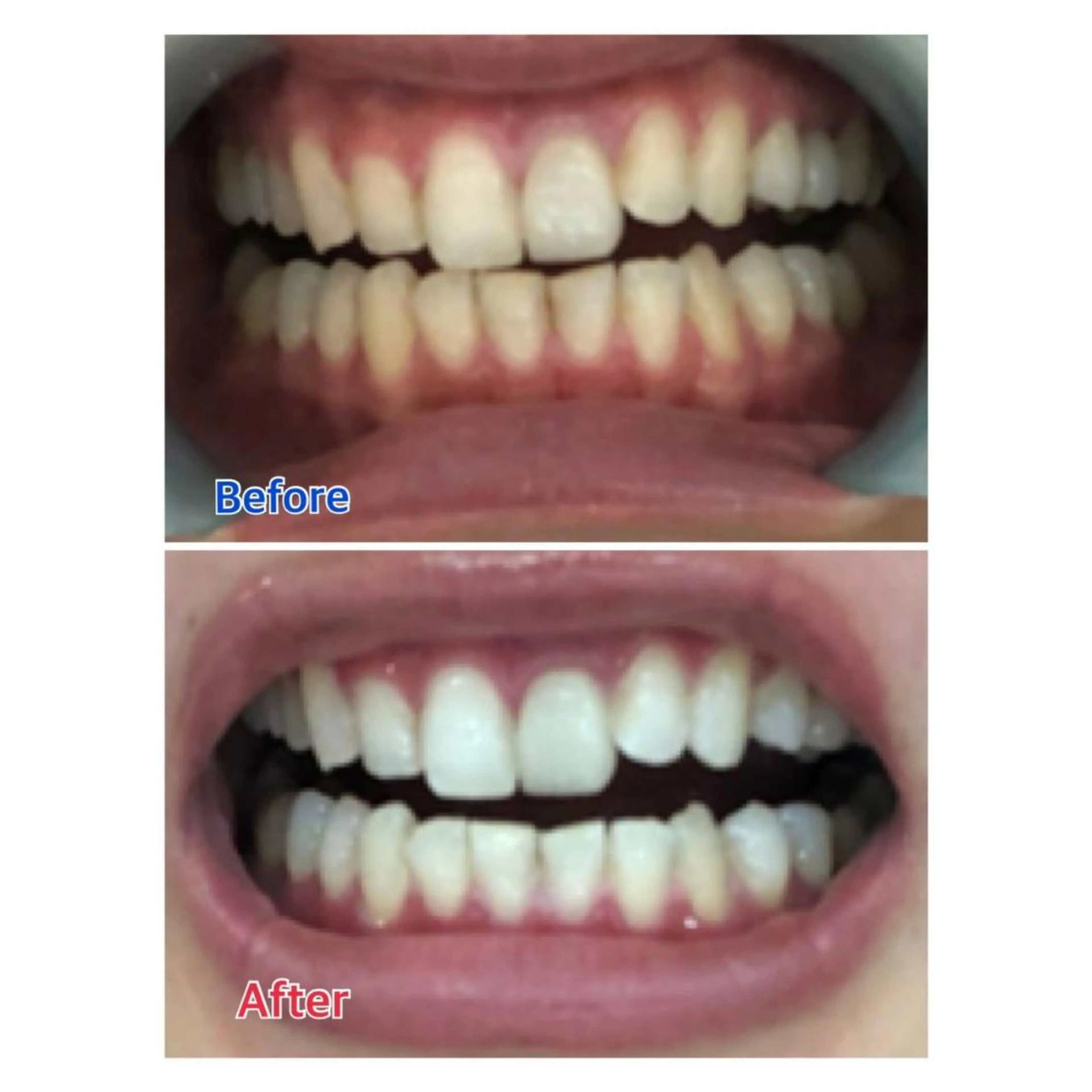 MBEAUTYSALON 千葉店・京成大久保所属・Melty 輝のその他イメージ