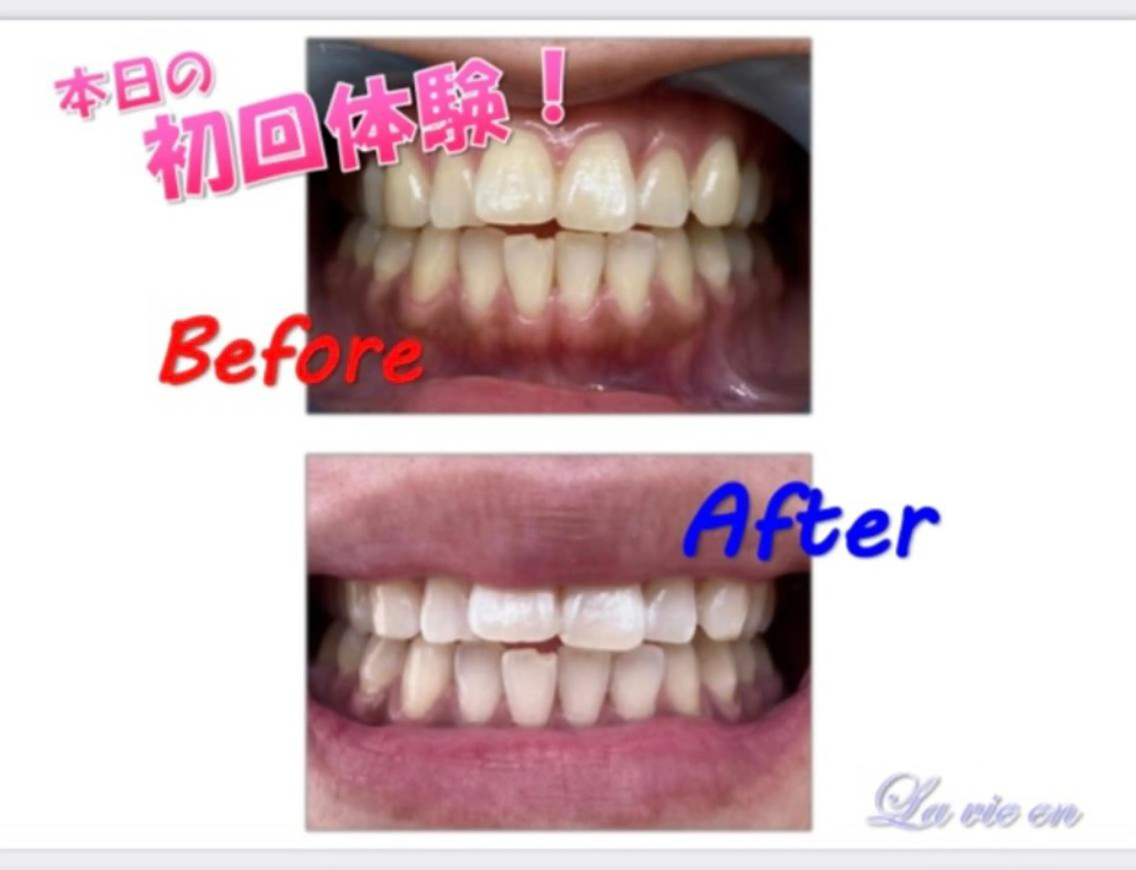 その他 セルフホワイトニングサロン　ラヴィアン所属・ホワイトニングサロン La vie enのその他イメージ