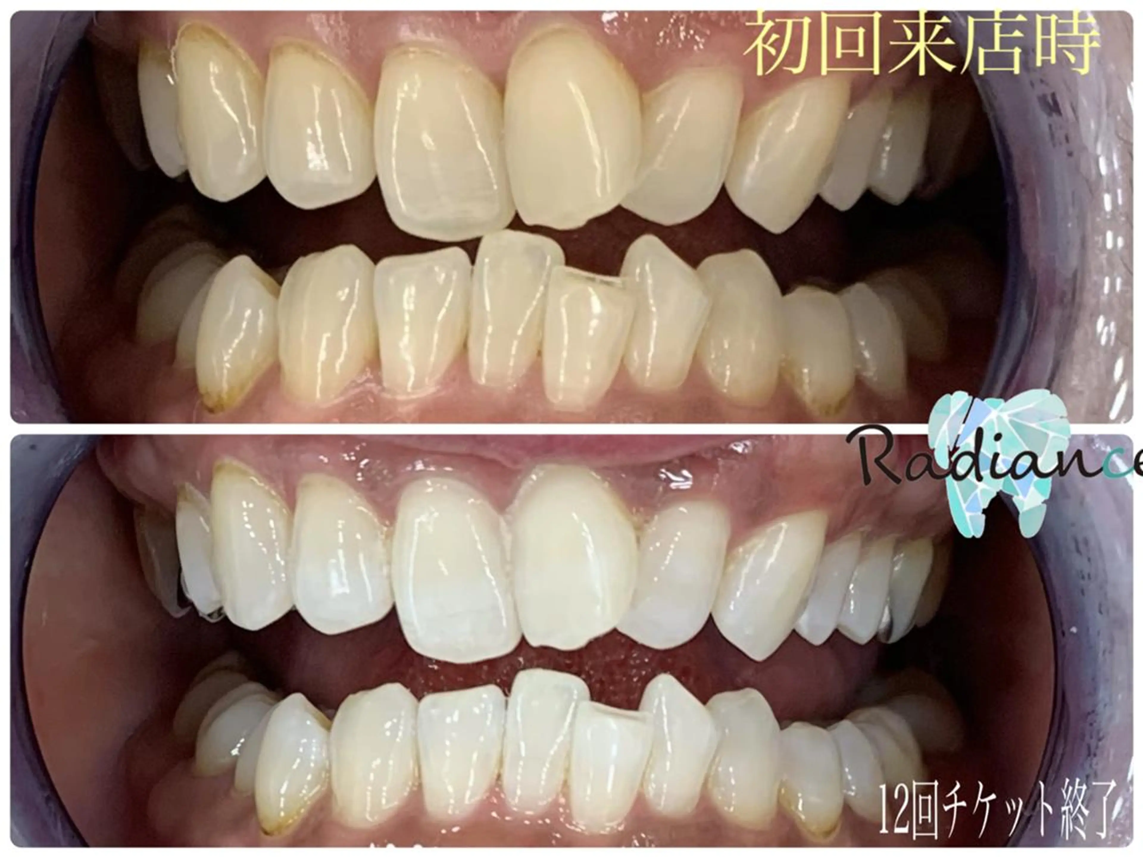 札幌ホワイトニング ラディアンス菊水店のその他イメージ