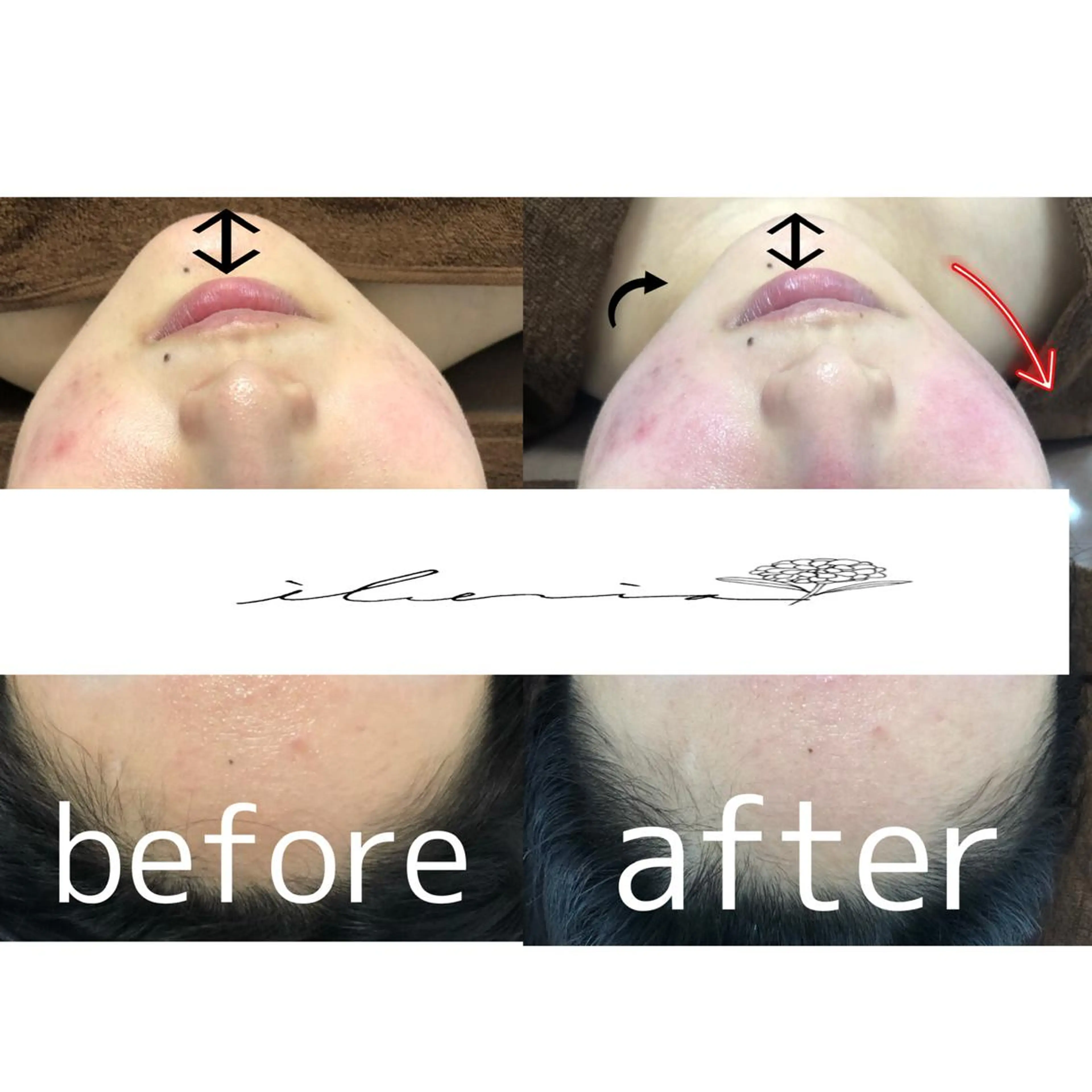 心斎橋痩身ダイエット 韓国.美容鍼.小顔のエステ・リラクイメージ