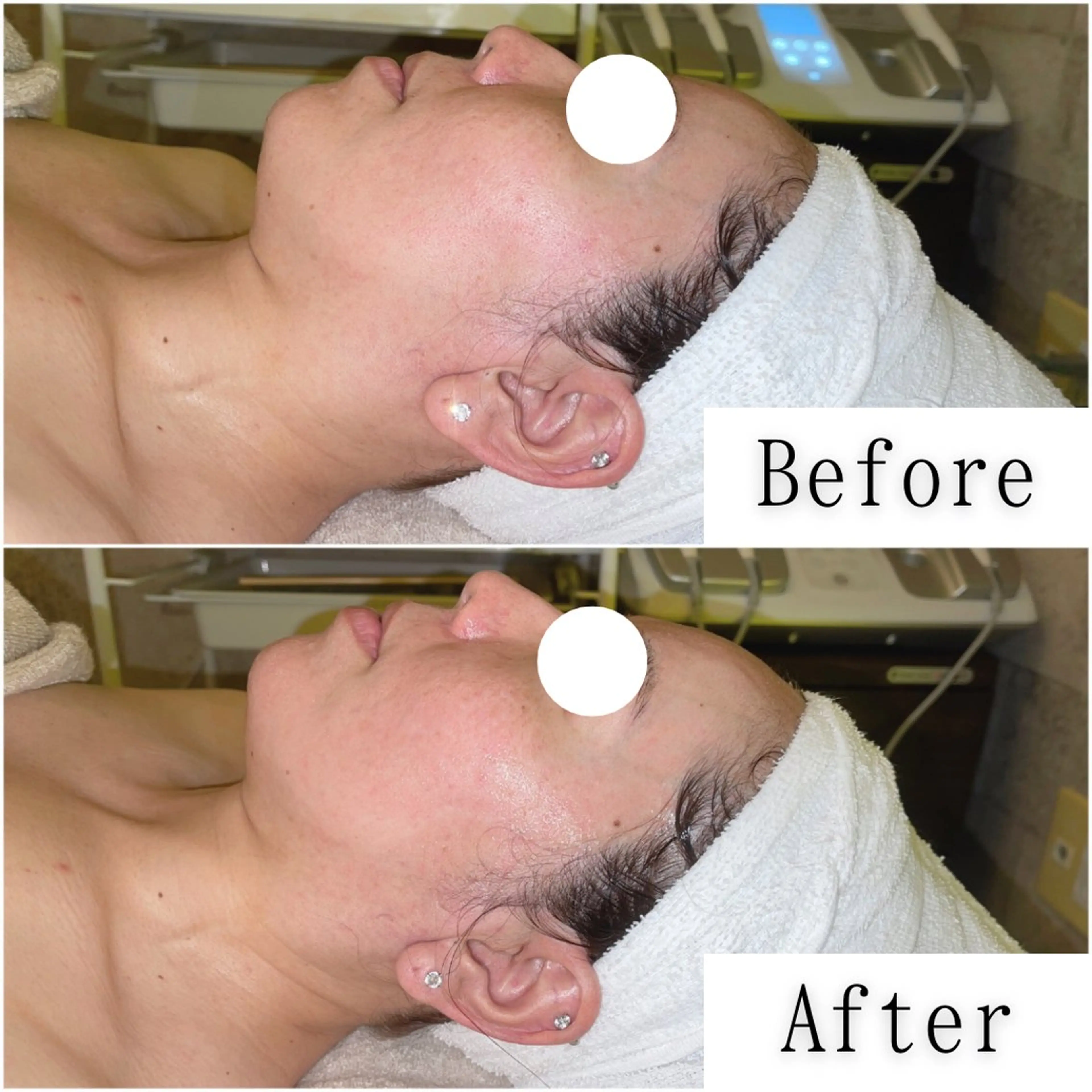 エステ SELF  BEAUTY gracia浦添店所属・gracia 浦添店のその他イメージ