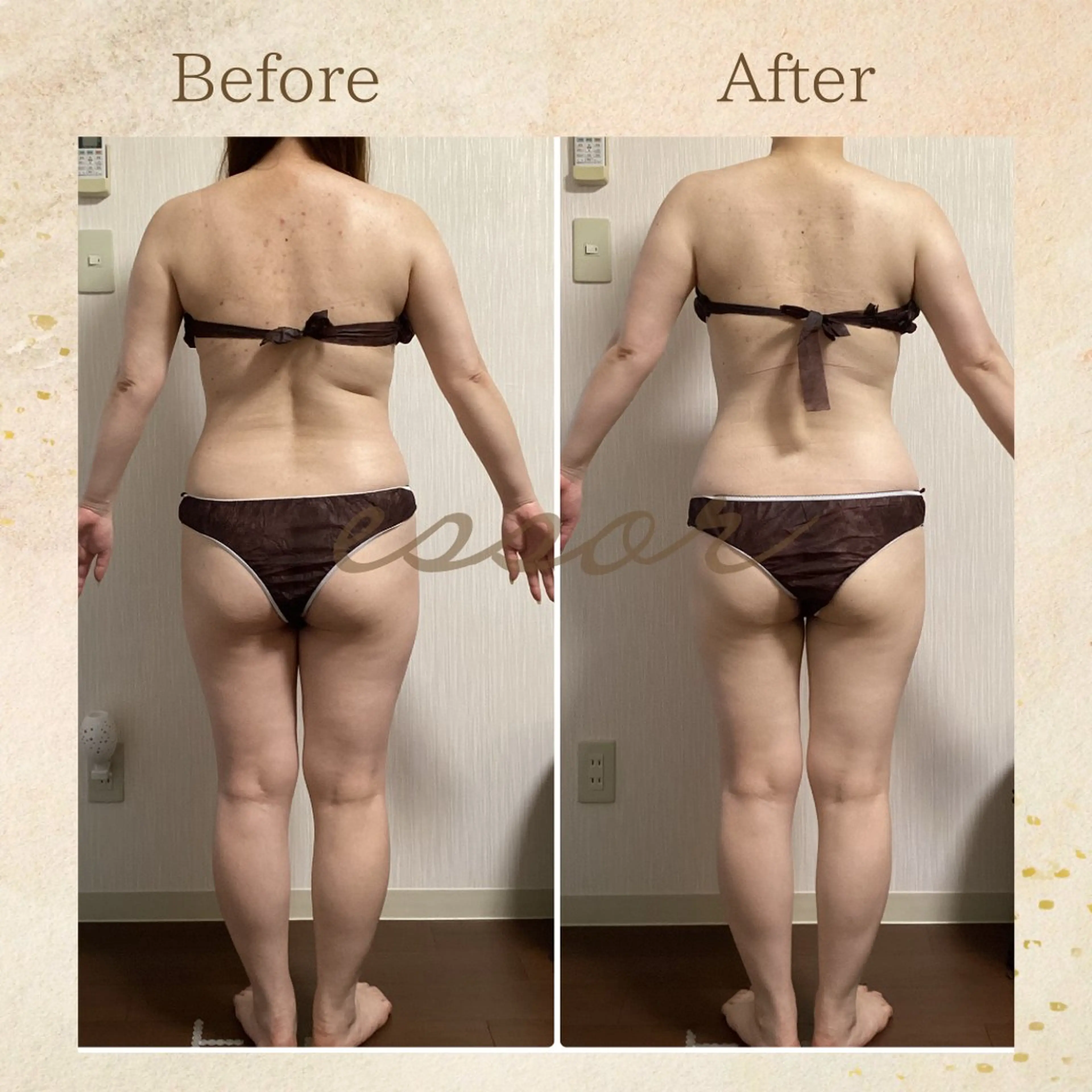 essor エソールのエステ・リラクイメージ