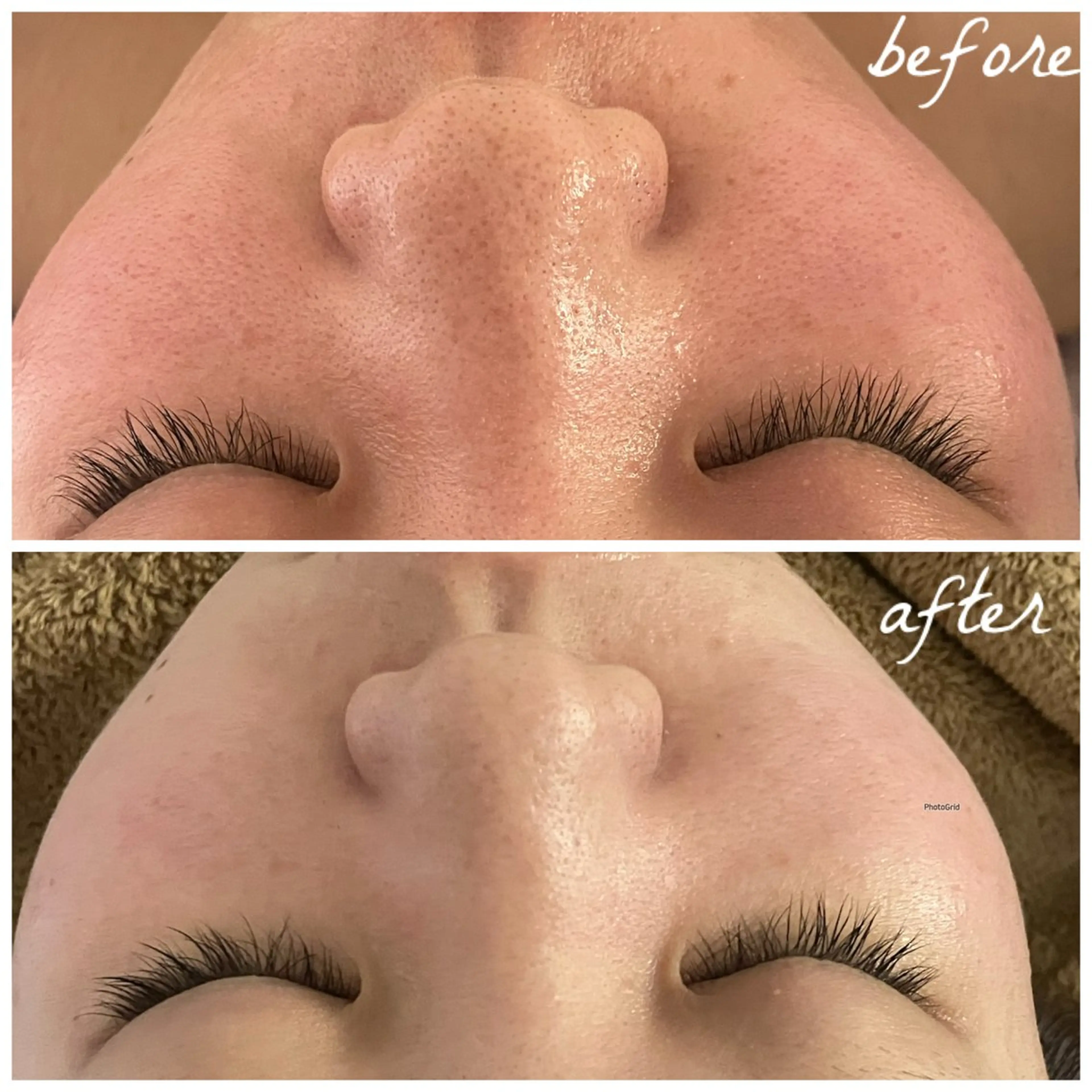 メンズ エステ メナード岐阜茜部 杉浦のエステ・リラクイメージ