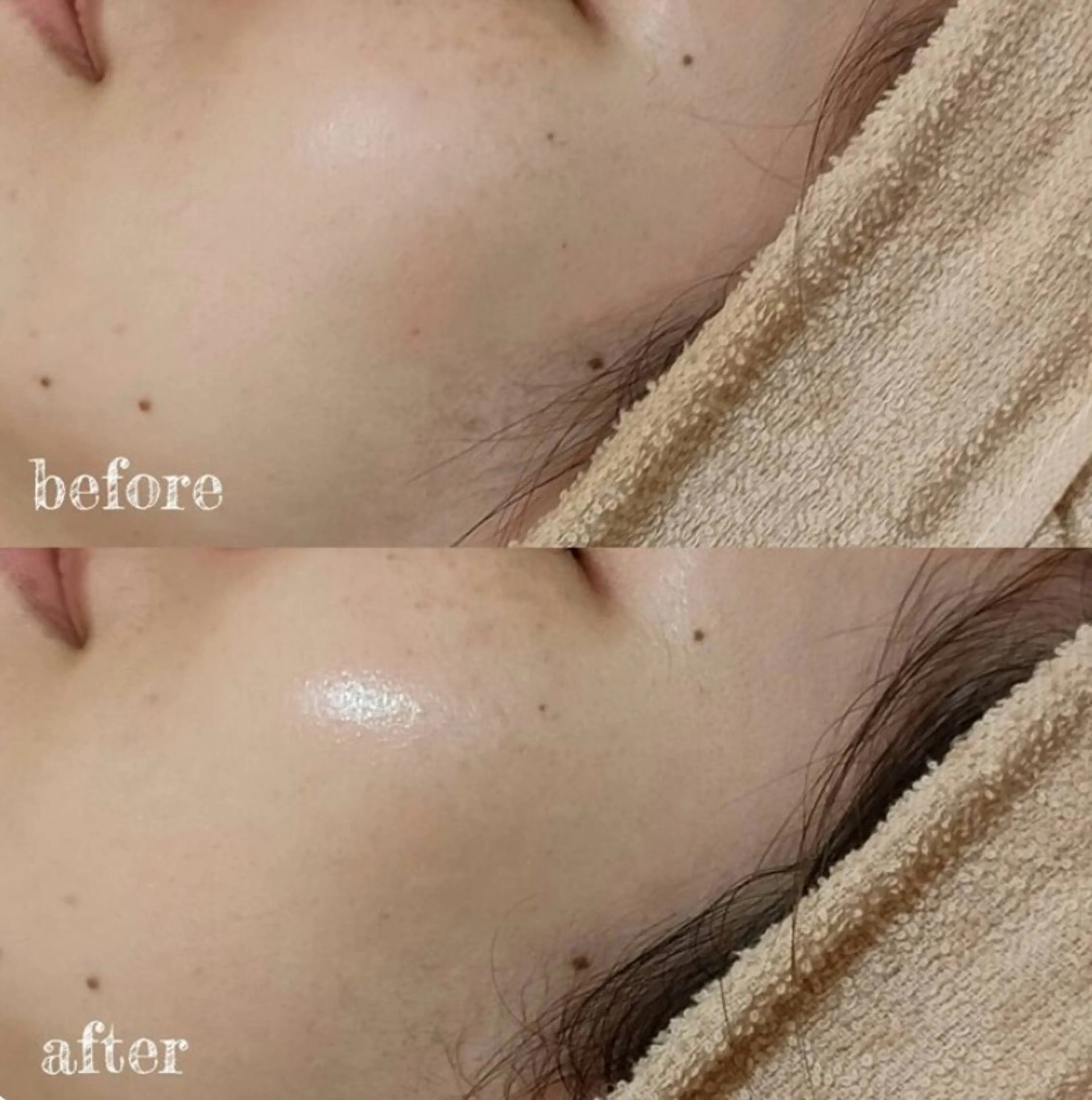 🔁【再来限定】2回目10％OFF💫ララピール¥7,920《通常¥8,800》の写真