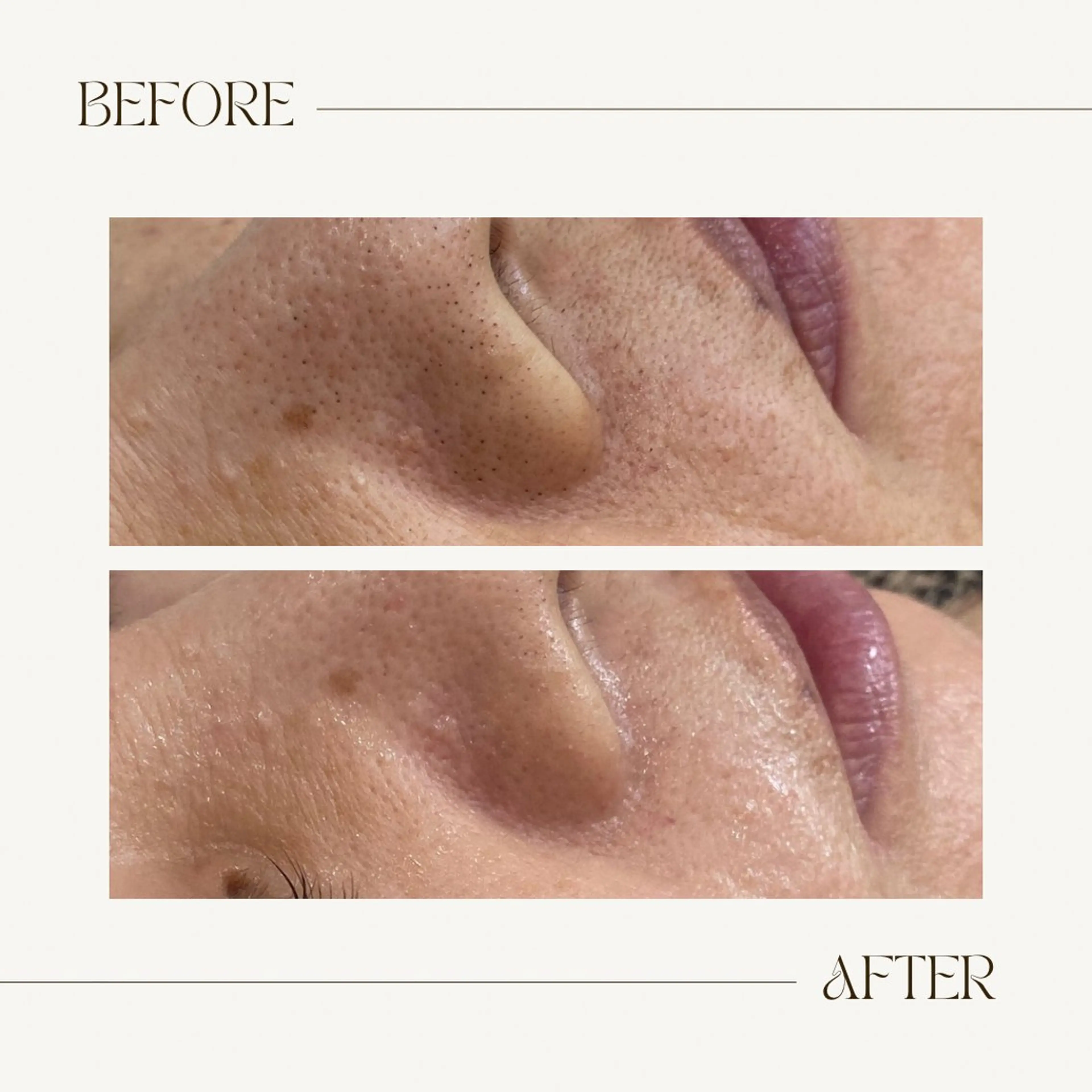 CEsalonEgg 齋藤のエステ・リラクイメージ