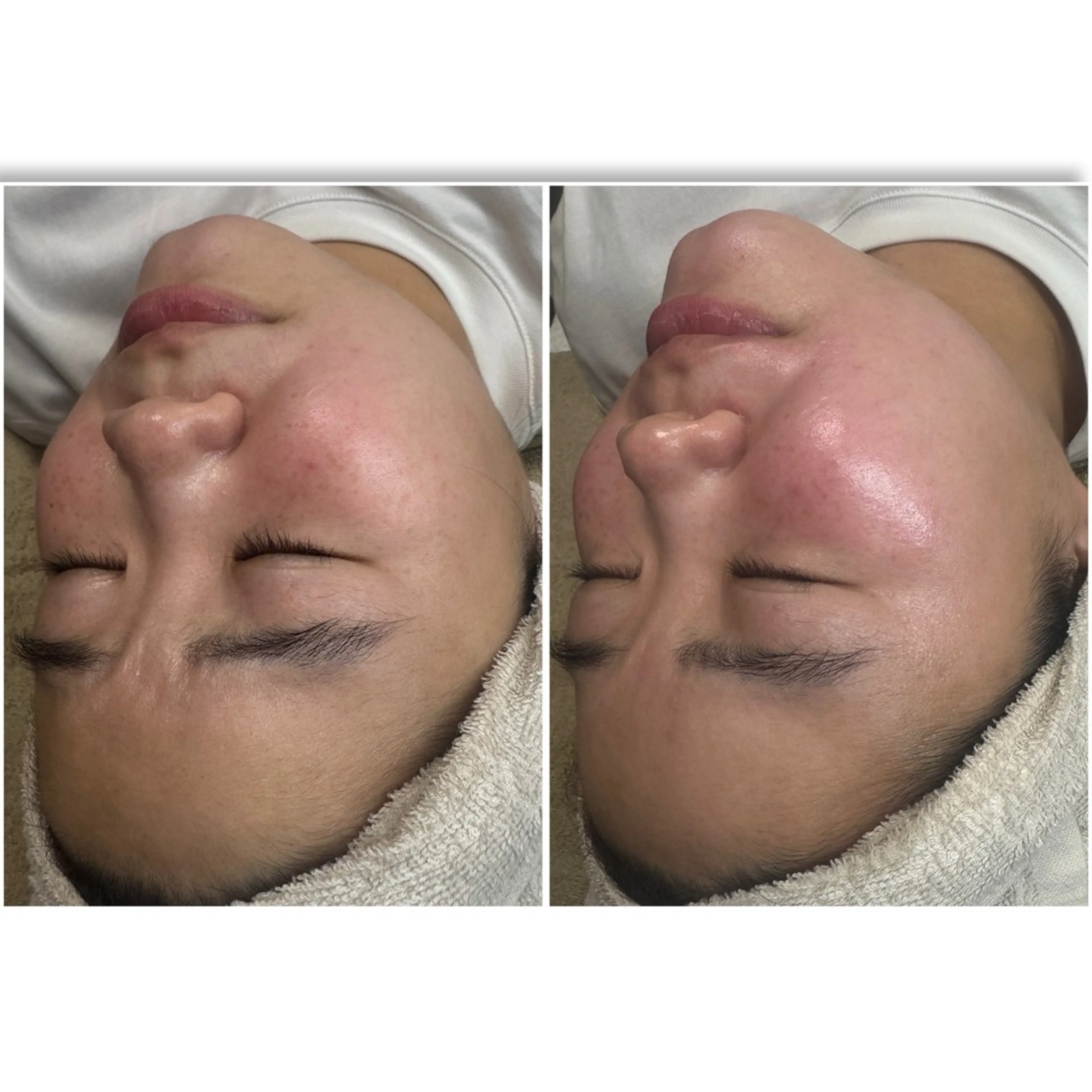 エステ yuuri. Sの眉毛・アイブロウイメージ