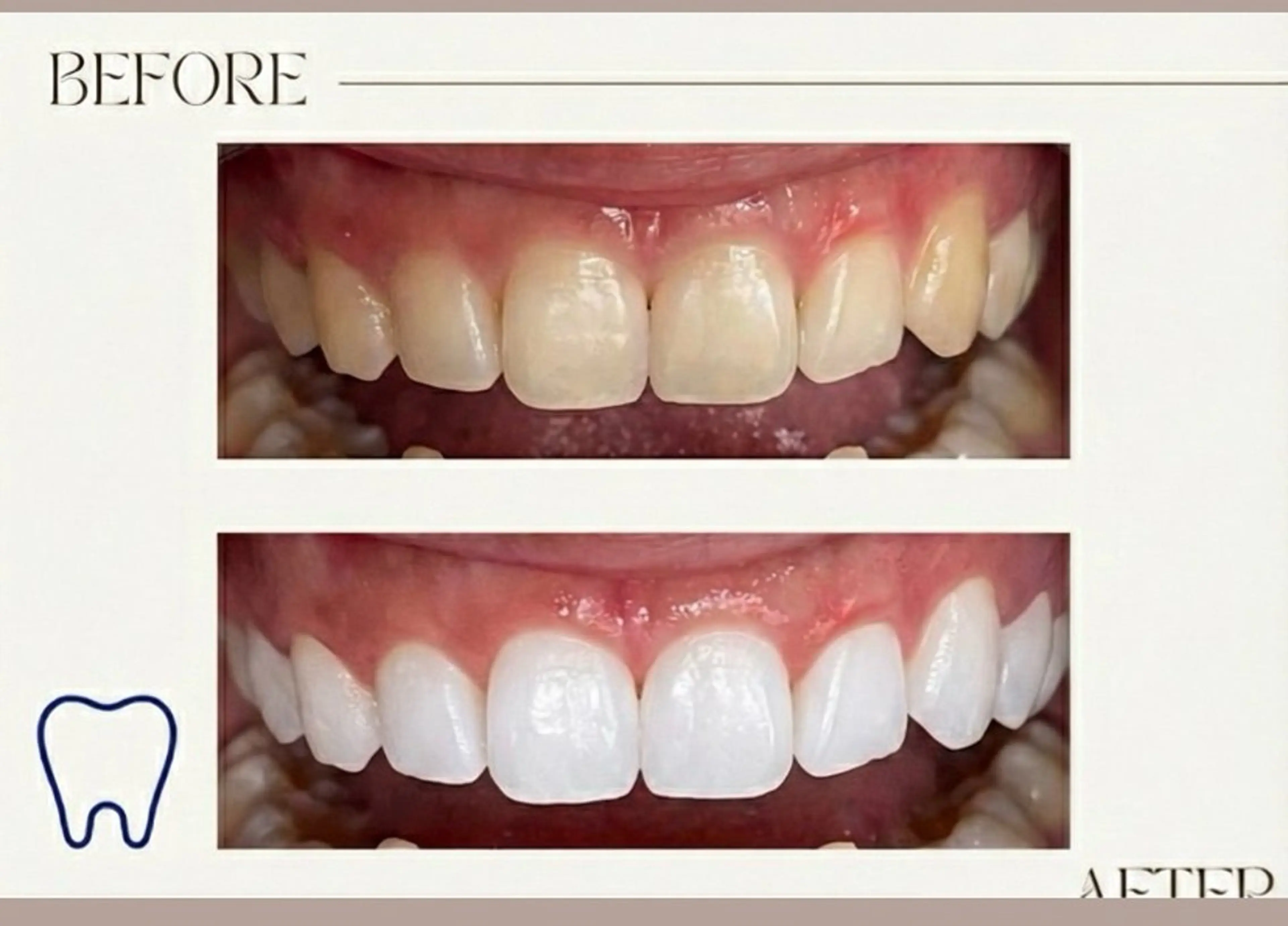 セルフホワイトニング サクッとホワイト   立川店所属・サクッとホワイト 立川店のその他イメージ