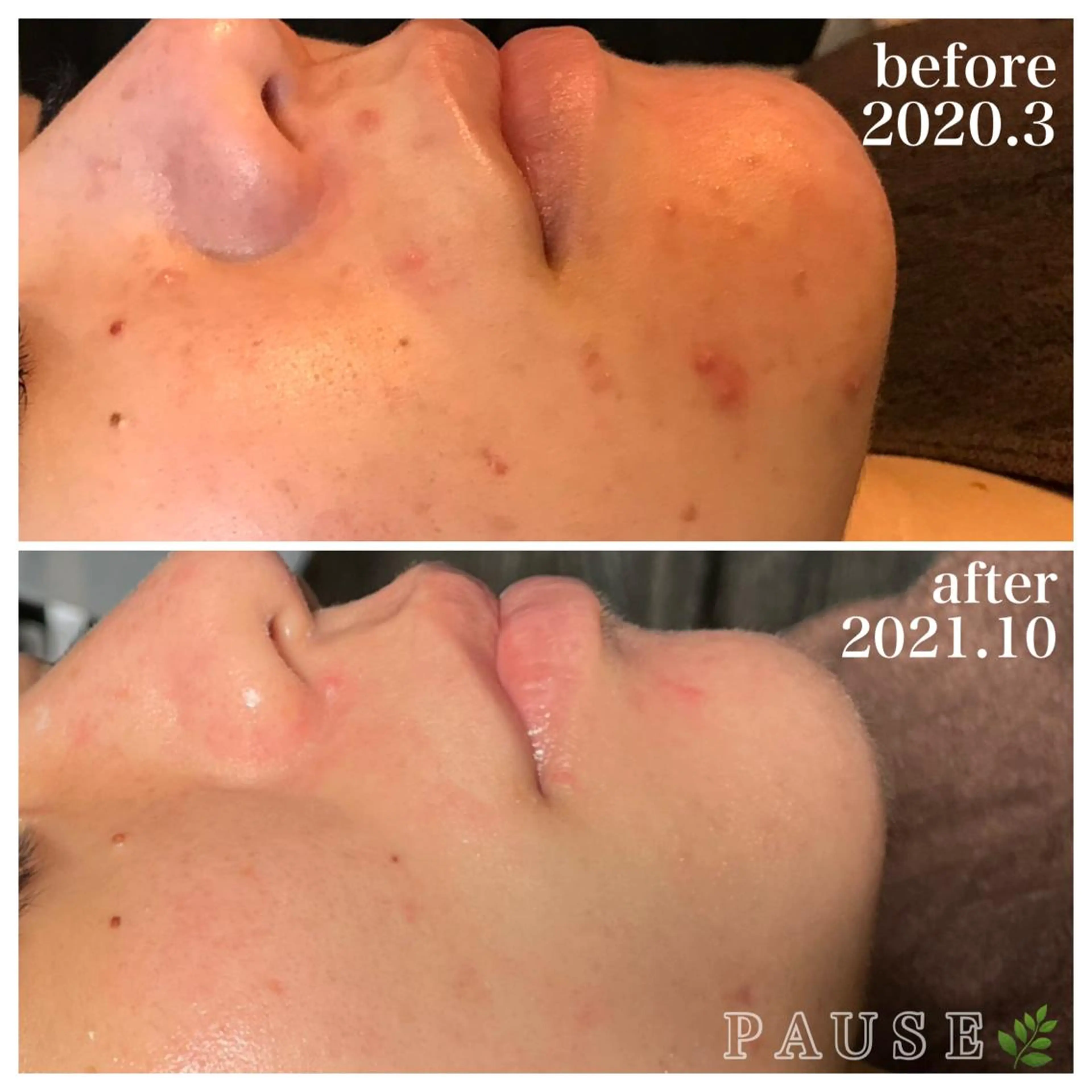 エステ 浜野 恵美のエステ・リラクイメージ