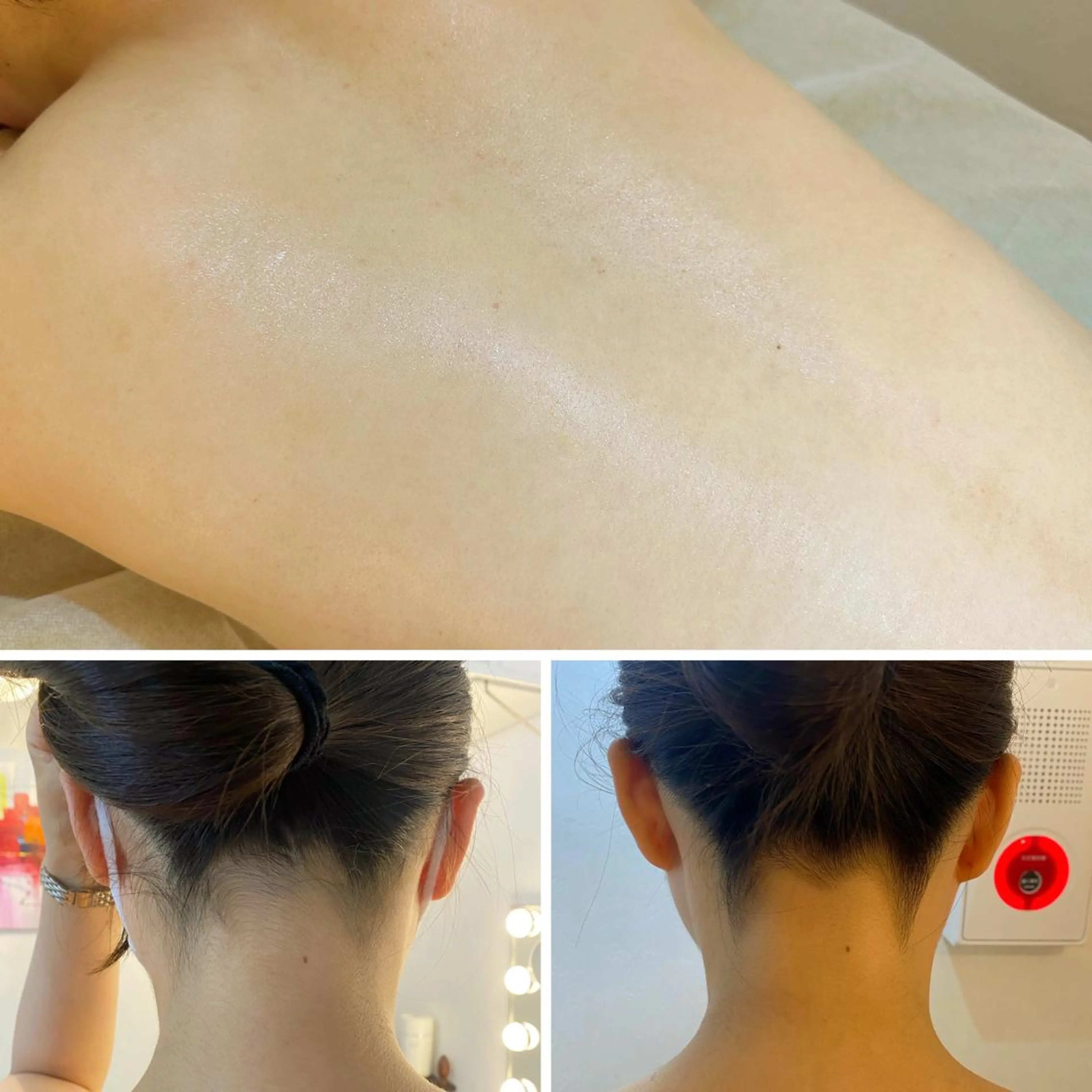 うなじ脱毛/美肌脱毛 LABELのエステ・リラクイメージ