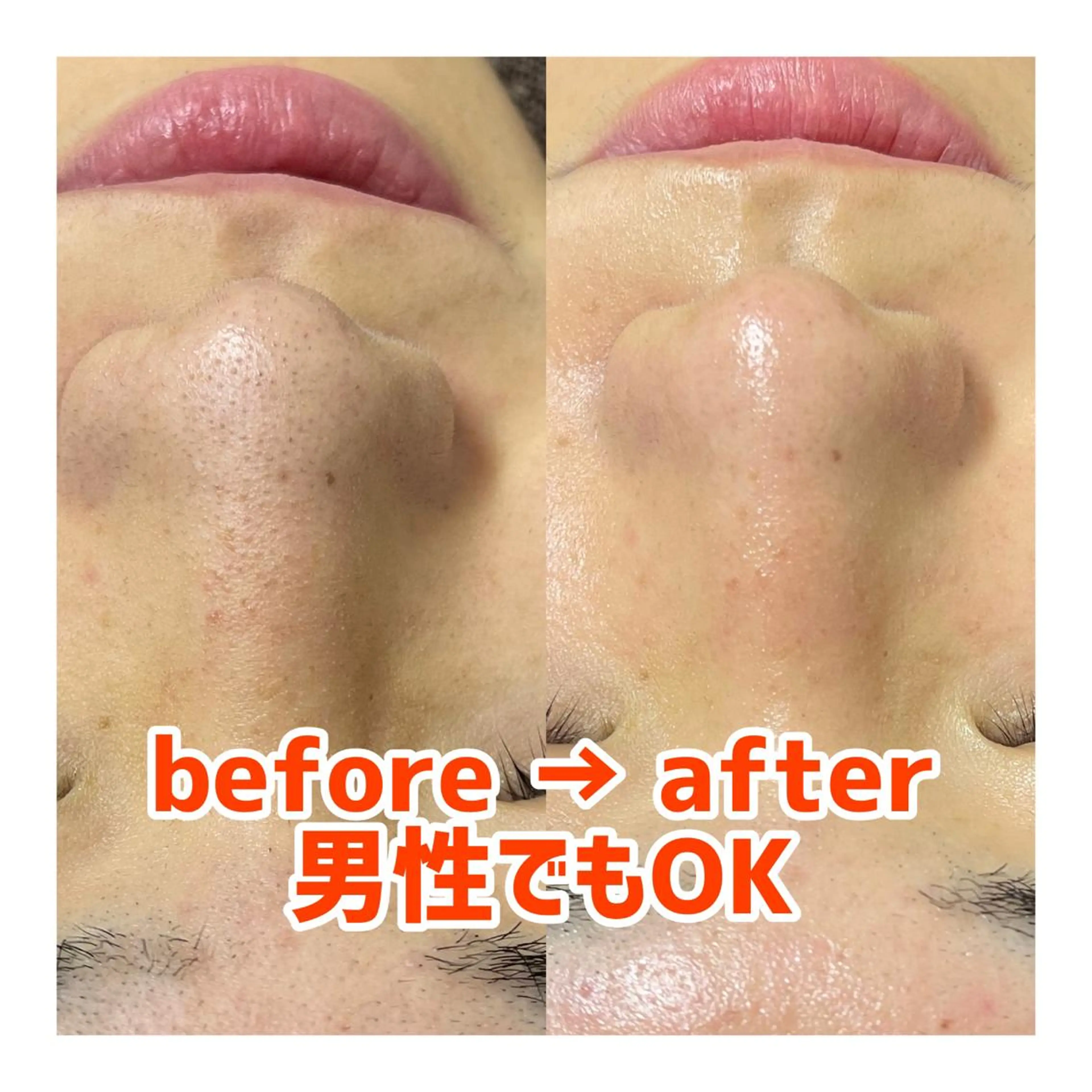 エステ 〜小顔・痩身・リラクゼーション〜　　Y&o Esthetic  Salon所属・HANA MIKIの眉毛・アイブロウイメージ