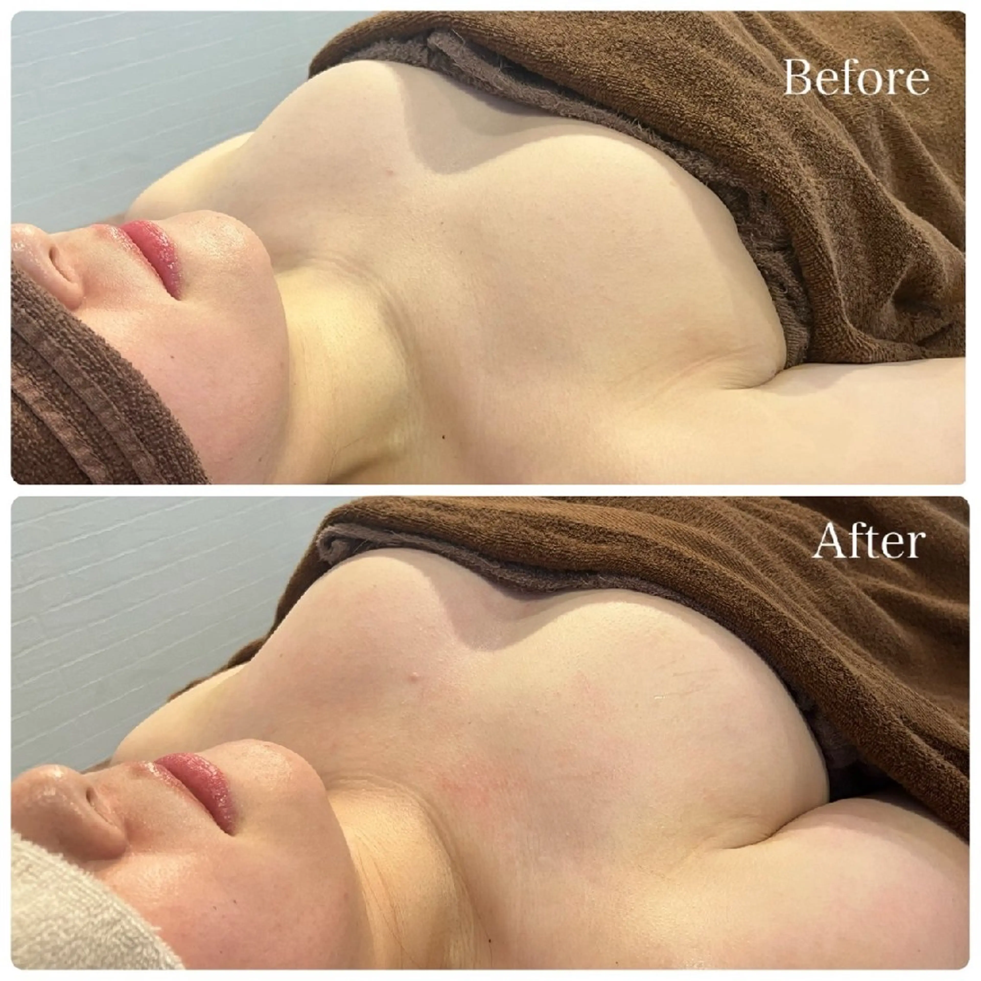 オリジナルバストアップ＆ケア(モニター限定)の写真