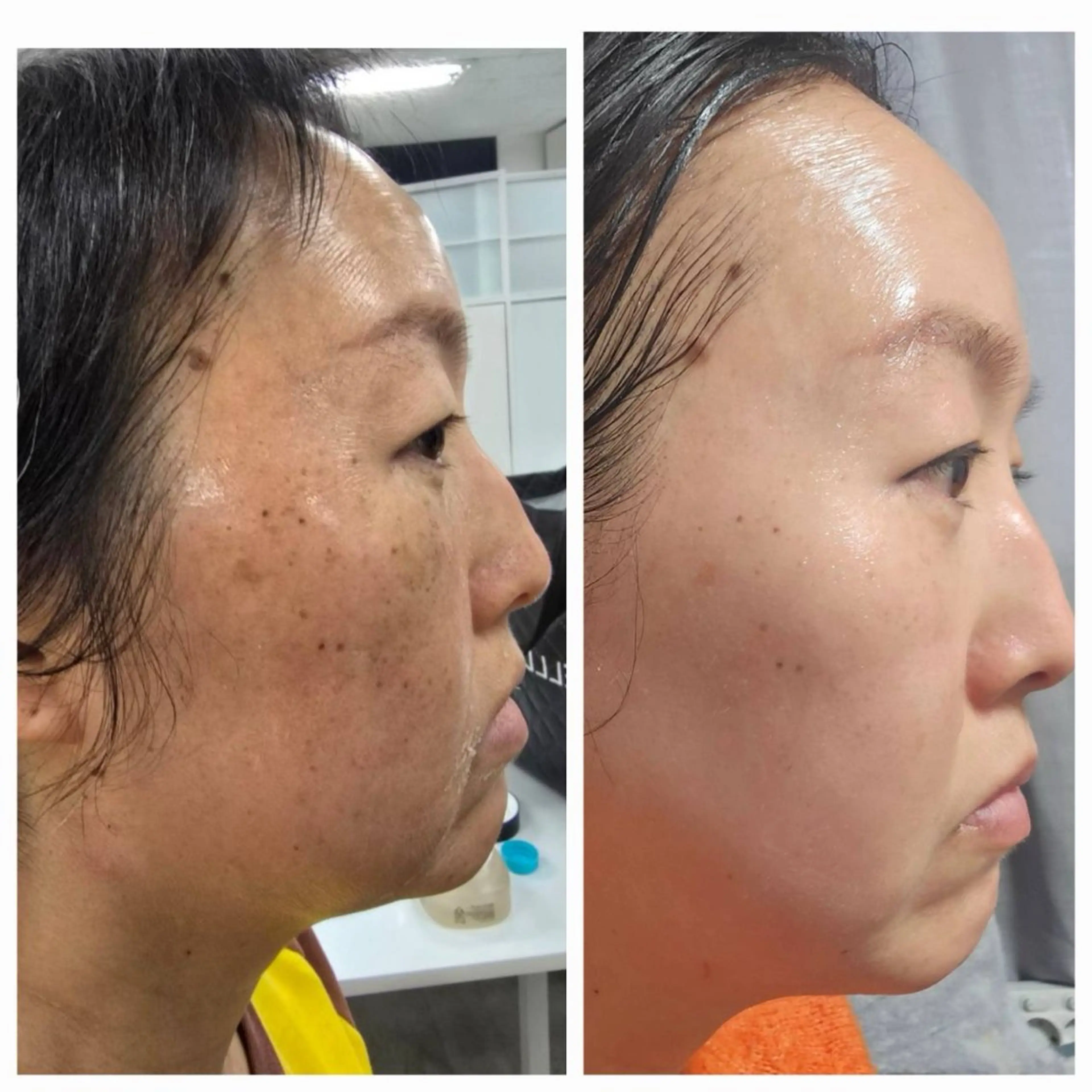 エステ 小顔/たるみ/黒ずみ除去専門サロン/SONA 大和西大寺店所属・【小顔専門看護師 サロンSONA】のエステ・リラクイメージ