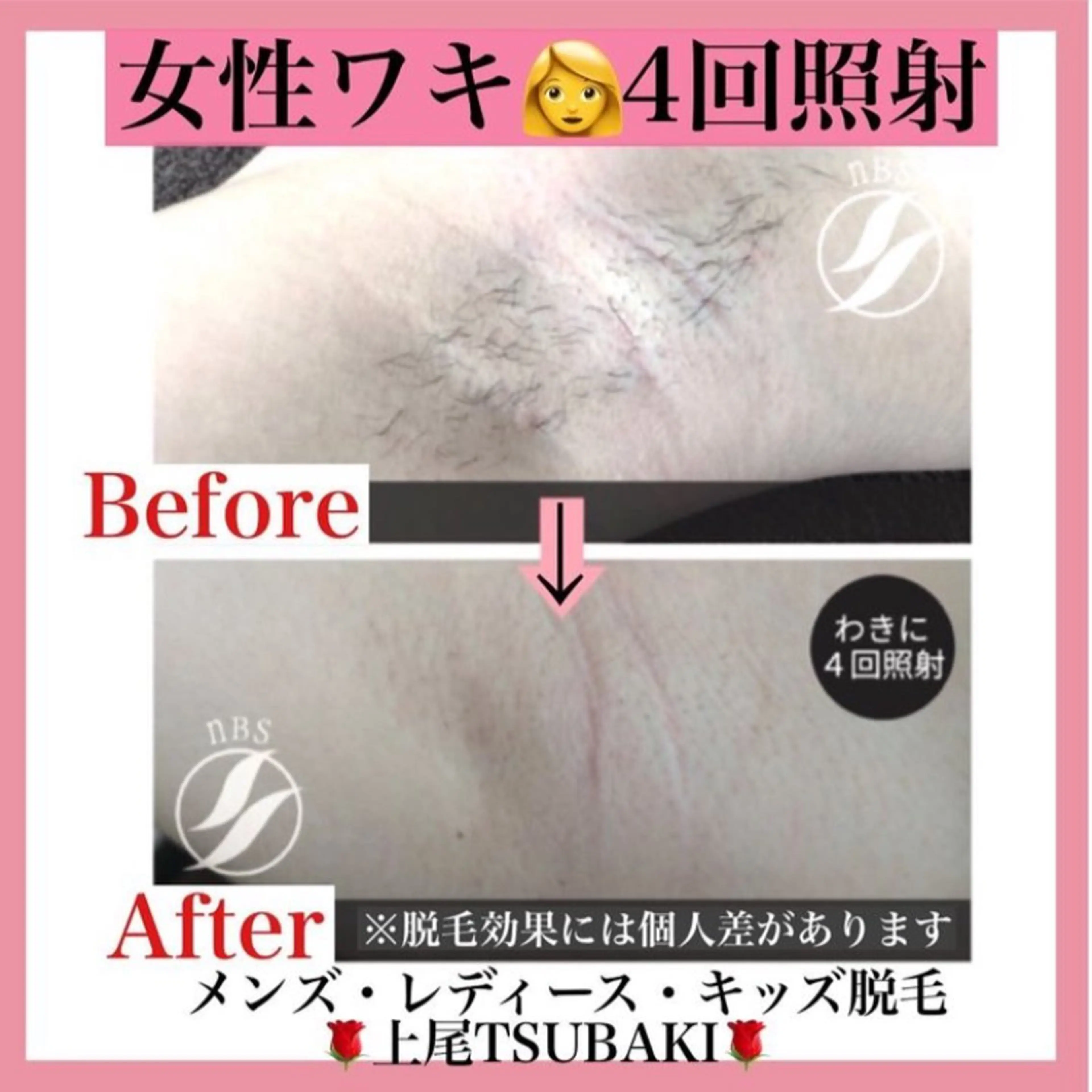 TSUBAKI上尾店所属・TSUBAKI上尾店 松下のエステ・リラクイメージ