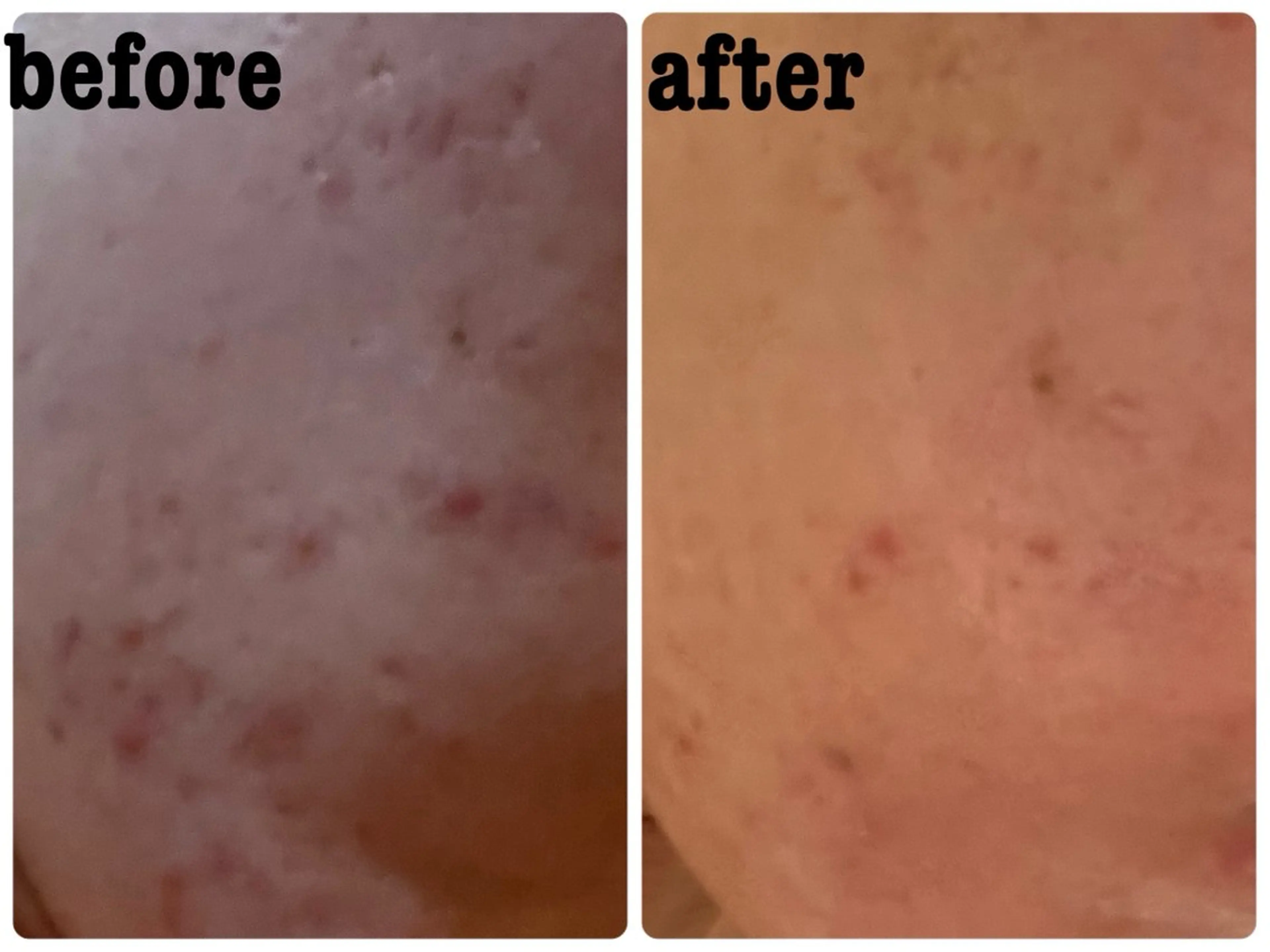 エステ SALON MAREのネイルデザイン