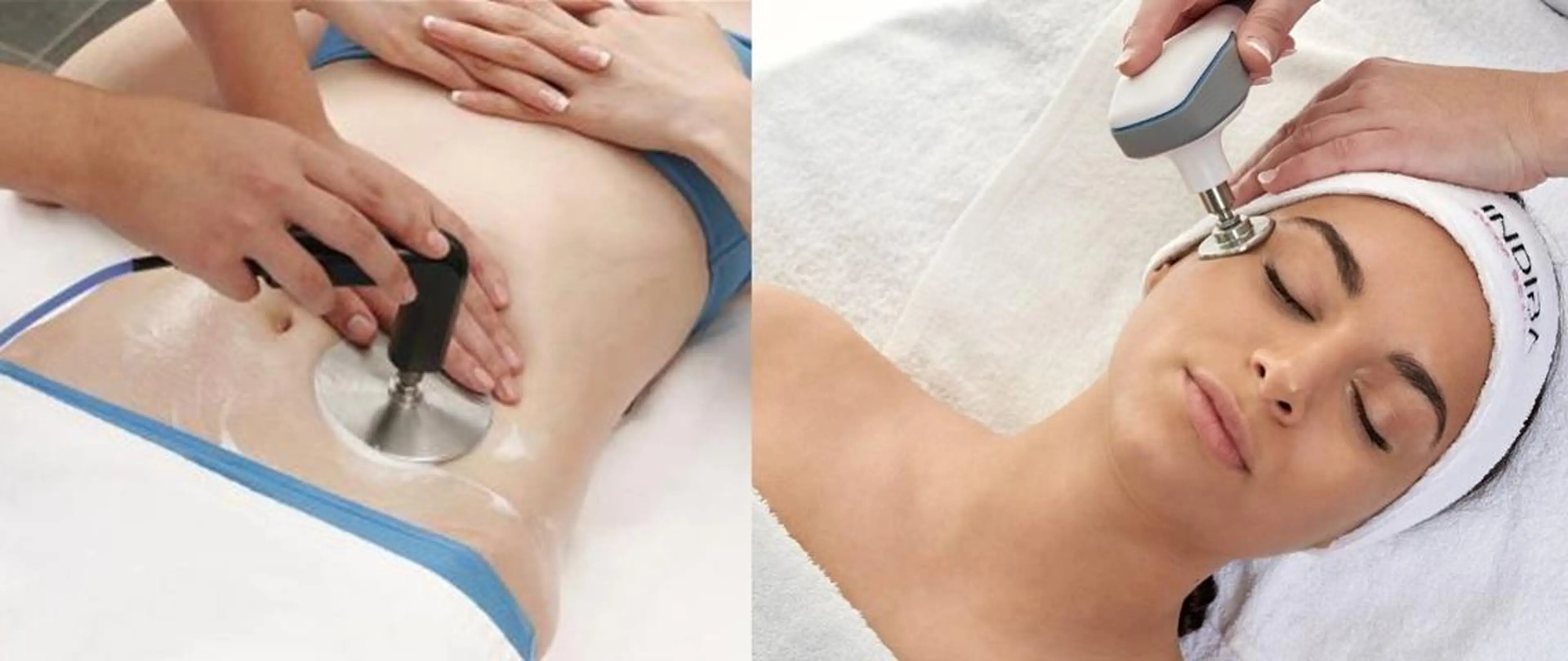 2回目～<吸引・形成術前>UPデ-ト前の方向け細胞燃焼¥9800の写真