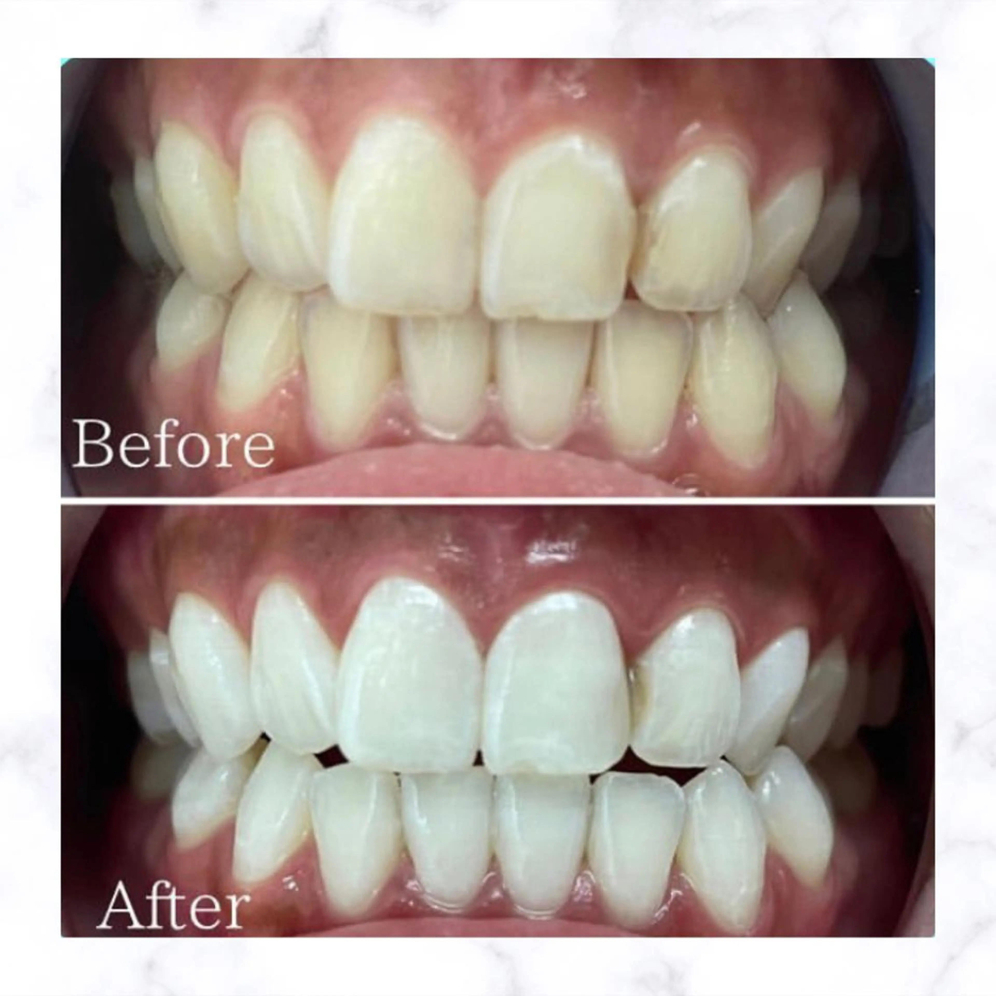 メンズ 学生（メンズ向け） ホワイトニング専門店 WHITE天神店のエステ・リラクイメージ