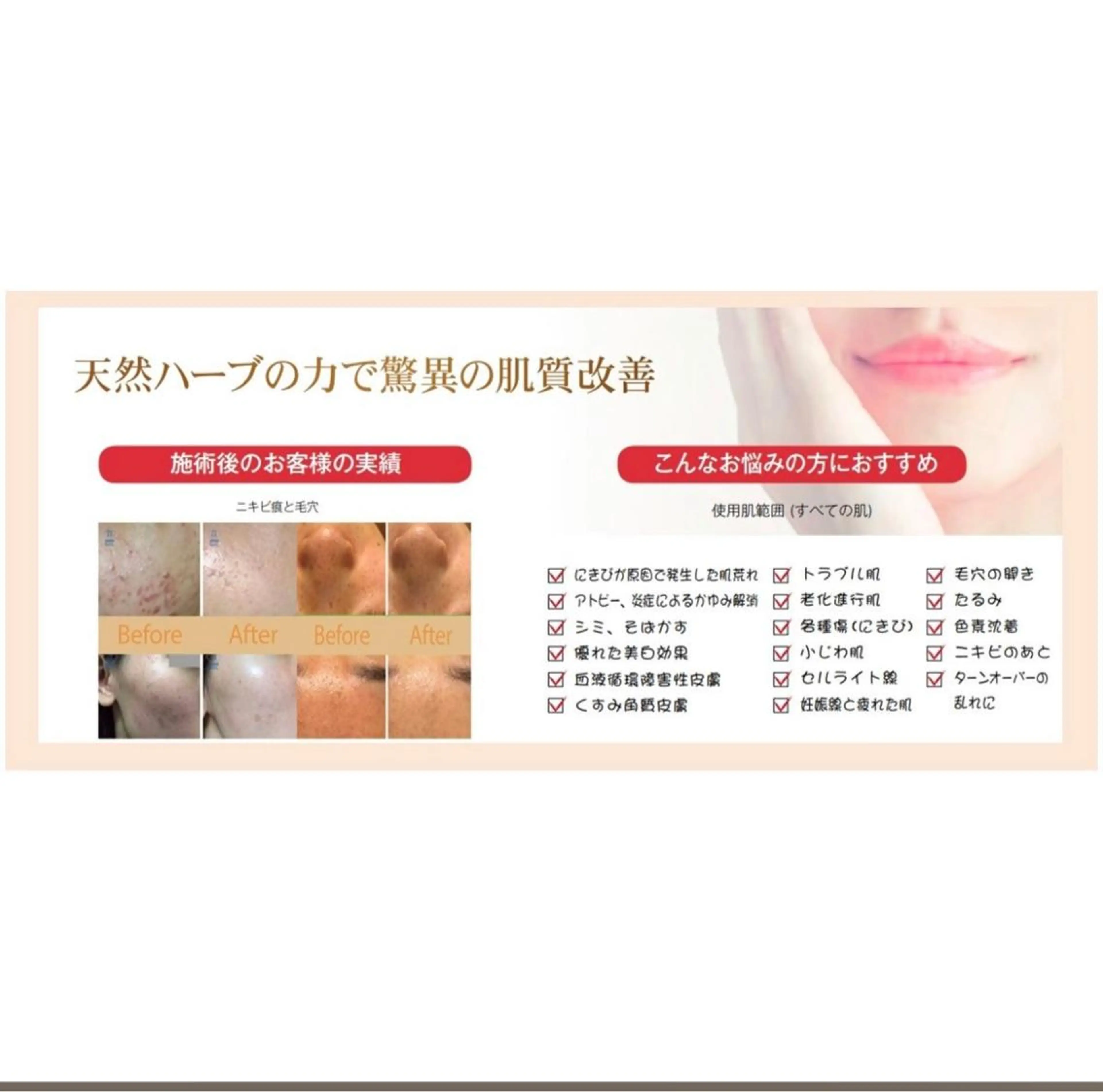 エステ miin所属・新小岩beauty saron miinのエステ・リラクイメージ