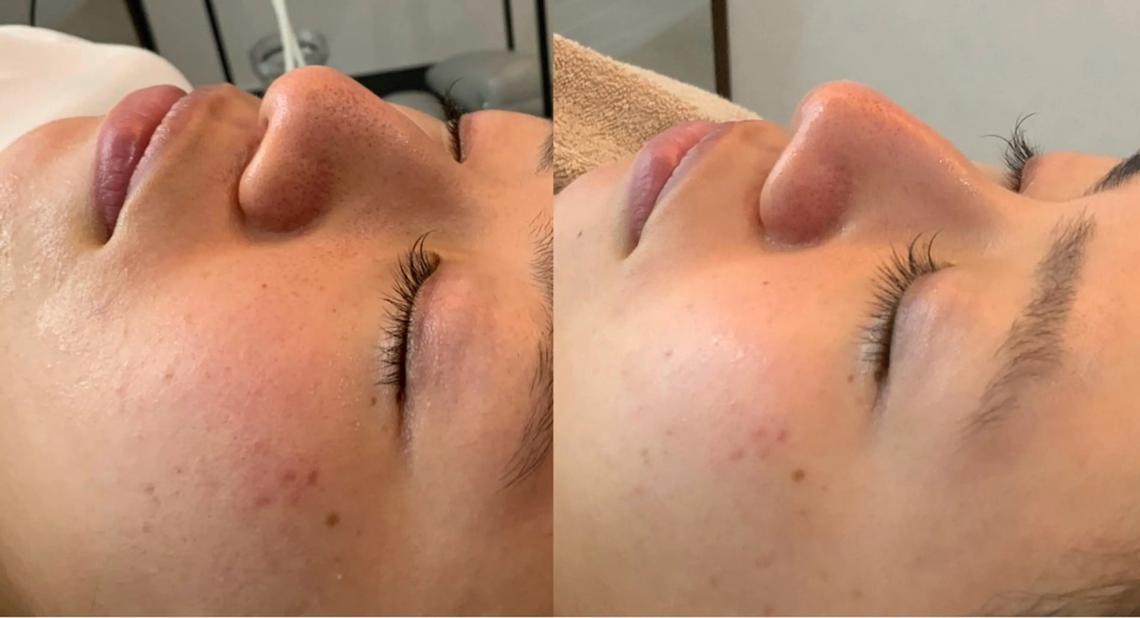 最速小顔・肌質管理 espoirマキのエステ・リラクイメージ