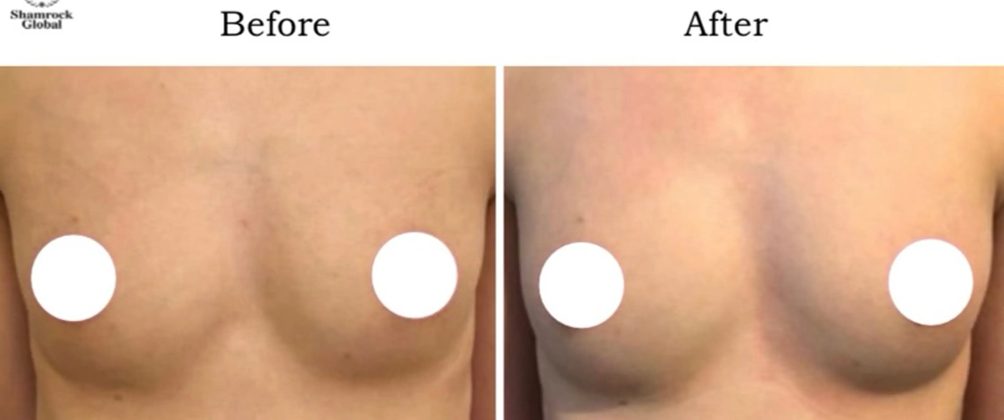 光フォト美容 エイジング、敏感肌のエステ・リラクイメージ