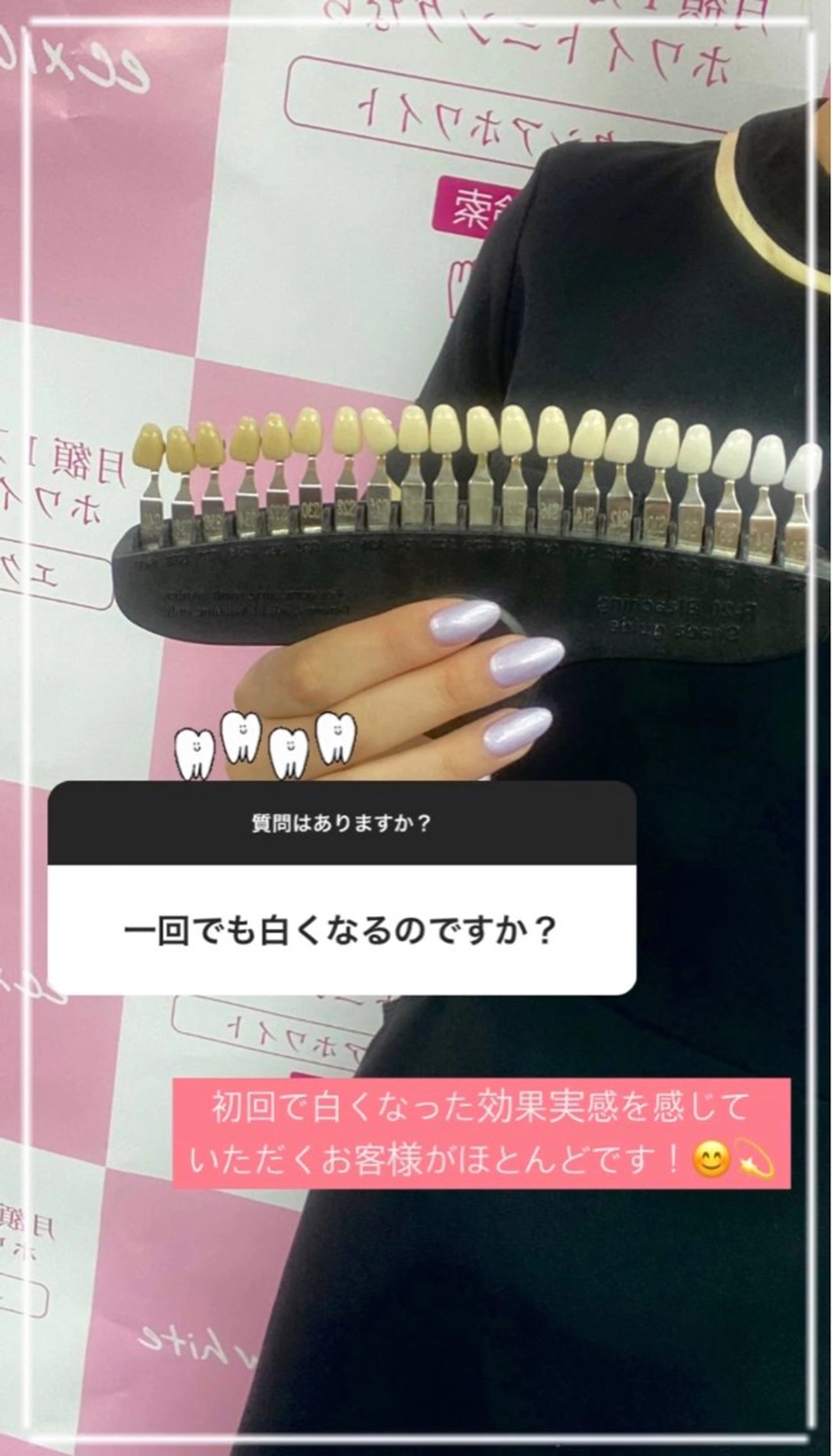 ecxia white 高田馬場所属・セルフホワイトニング エクシア 高田馬場のその他イメージ