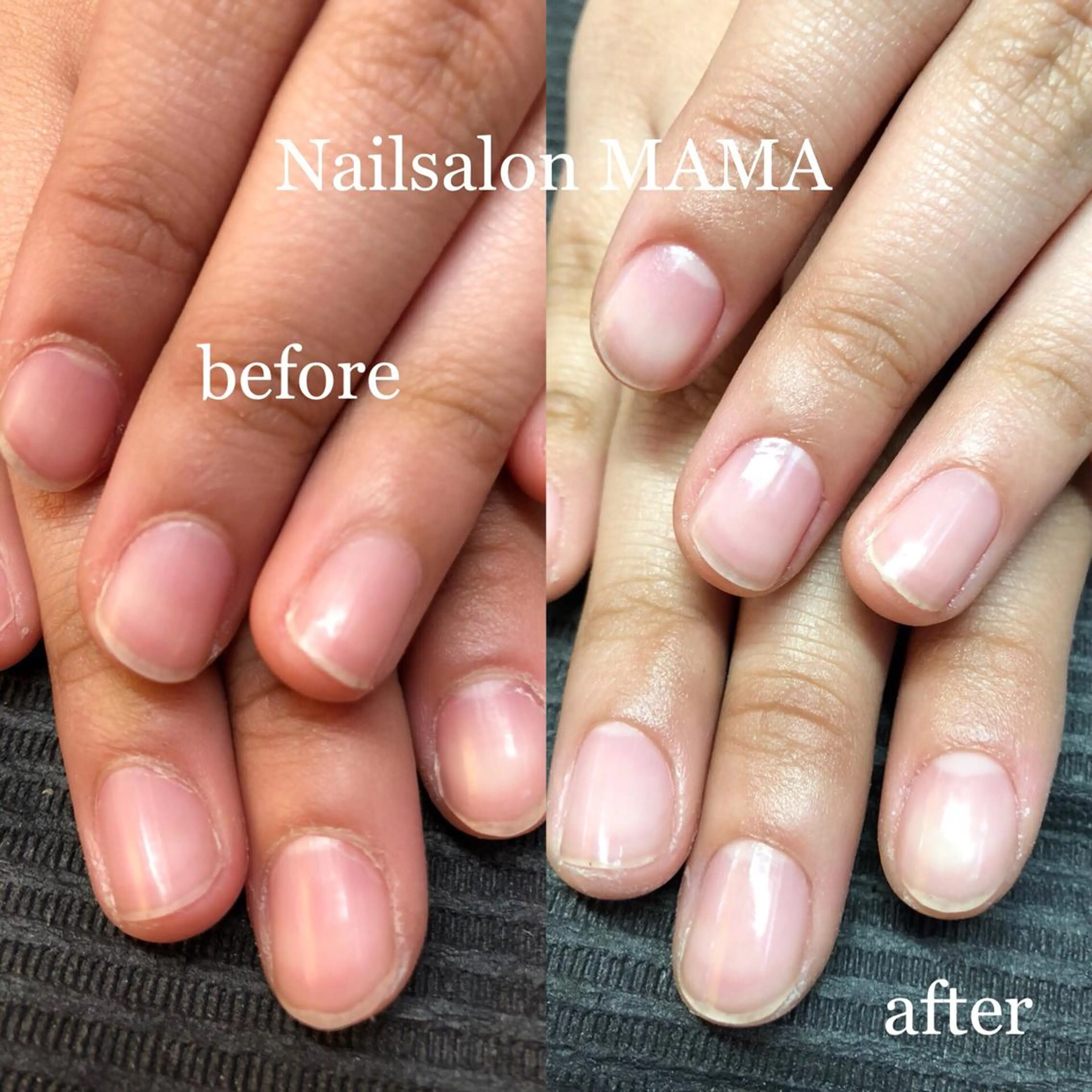 ネイルケアの写真