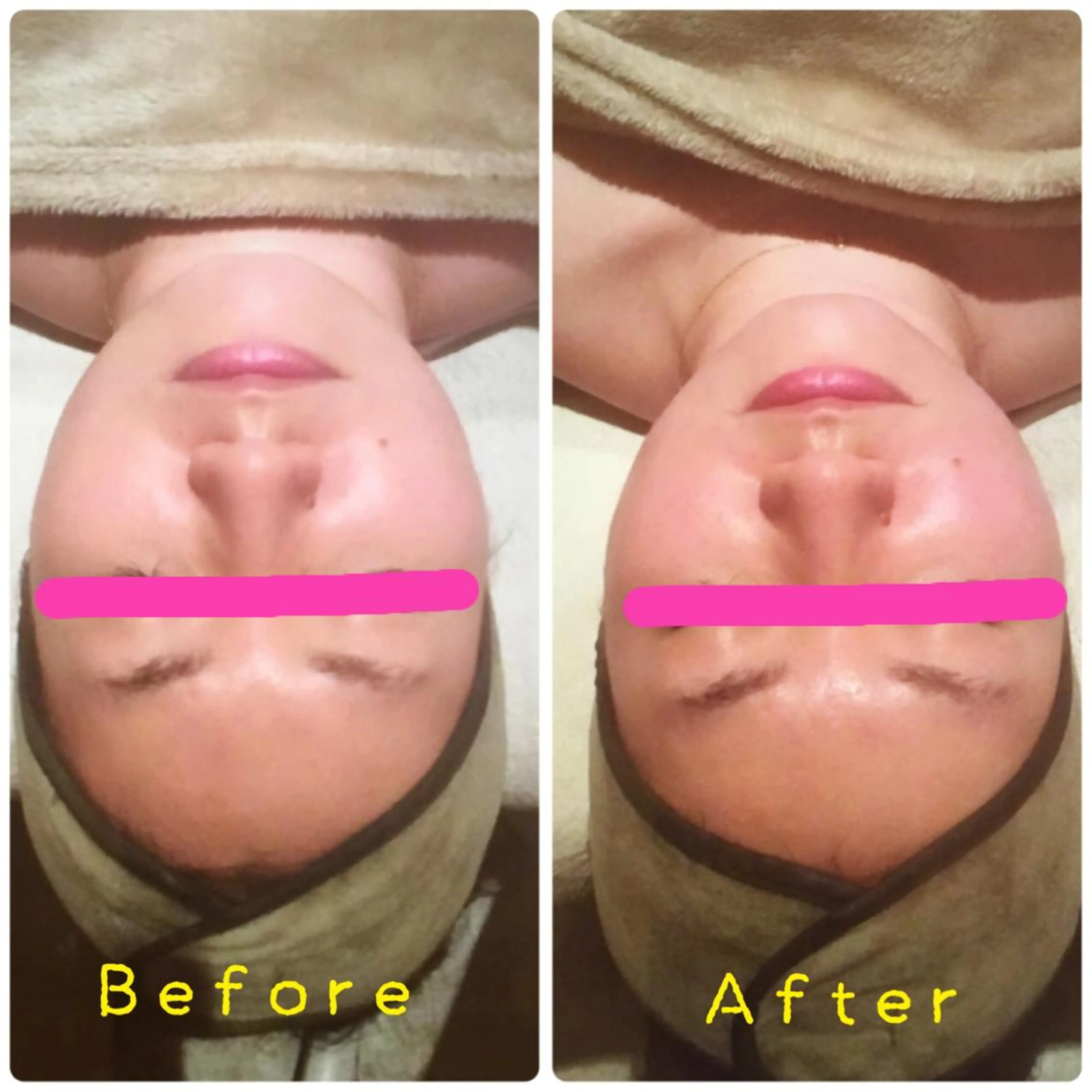 韓国コルギ ハーブピーリング専門  ALMOND所属・ALMOND yukinaのエステ・リラクイメージ