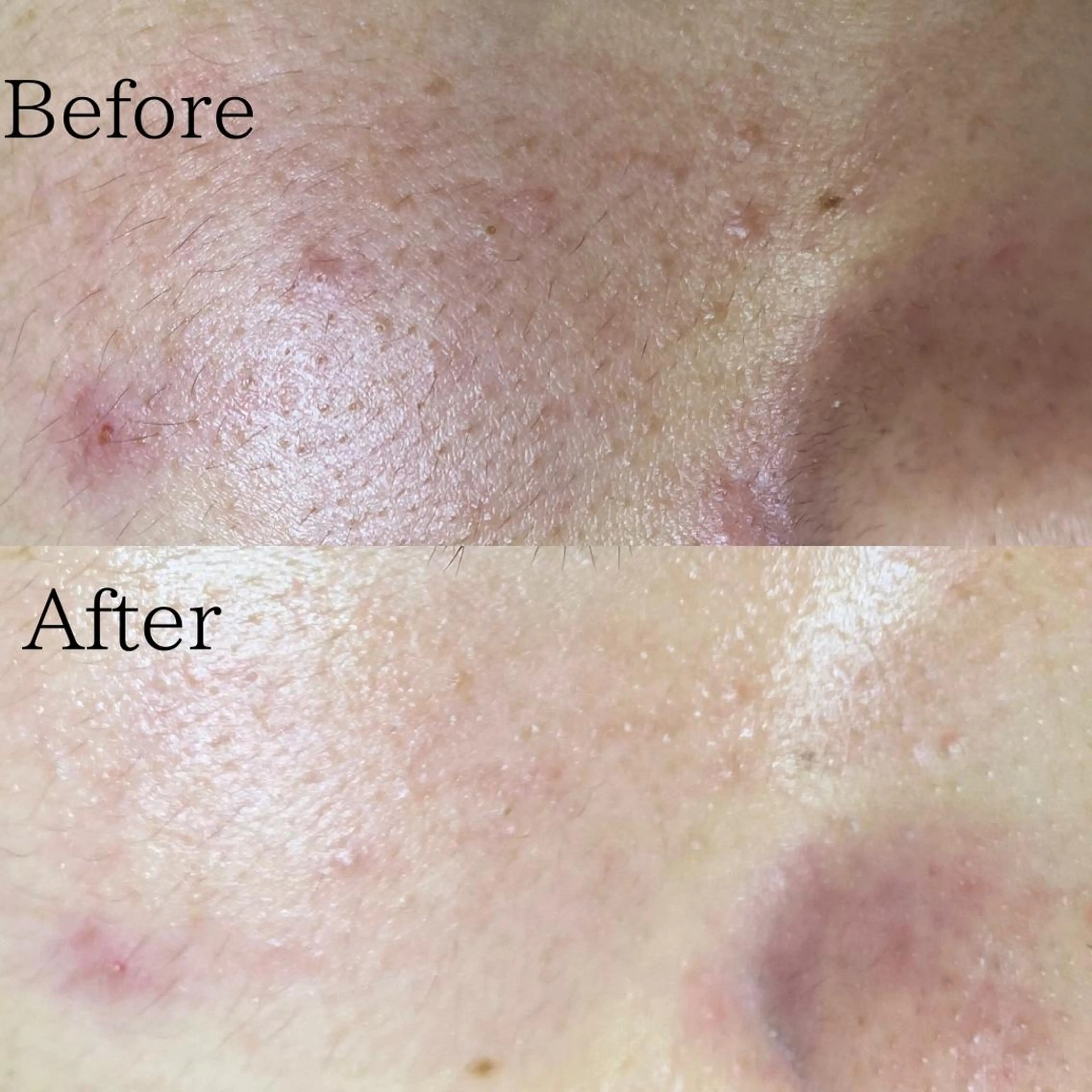 エステ エステサロン　Lazulisea所属・川口 春奈のエステ・リラクイメージ