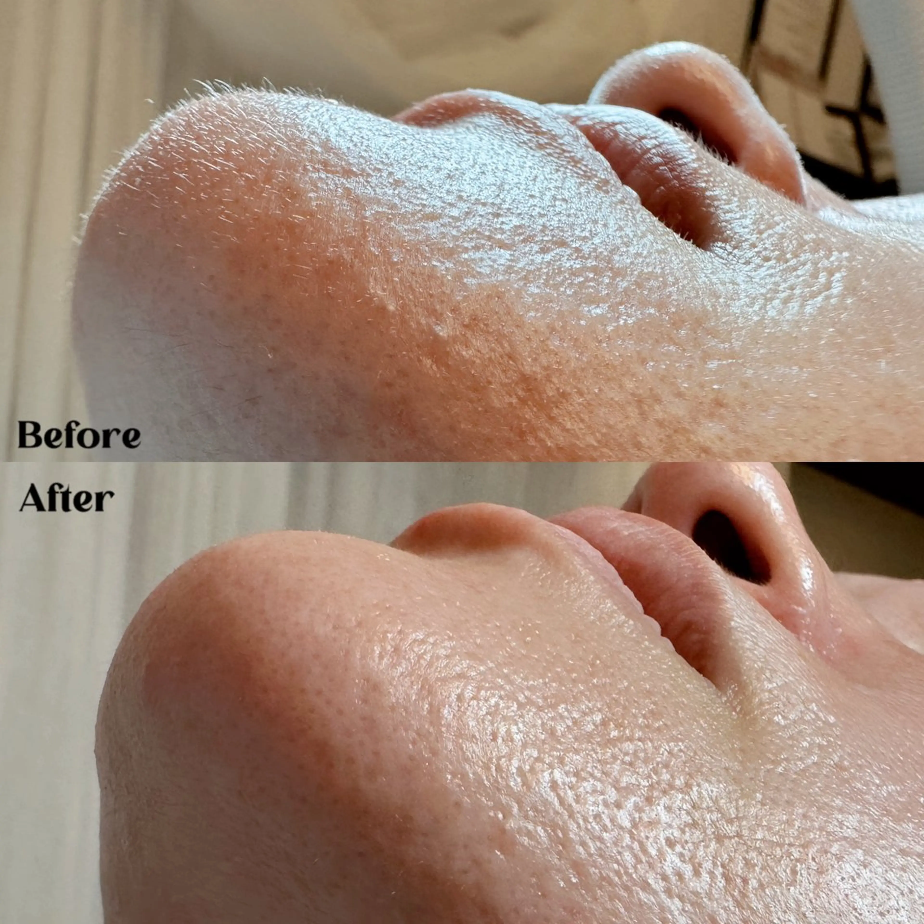 Hit. シュガーリング豊橋のエステ・リラクイメージ