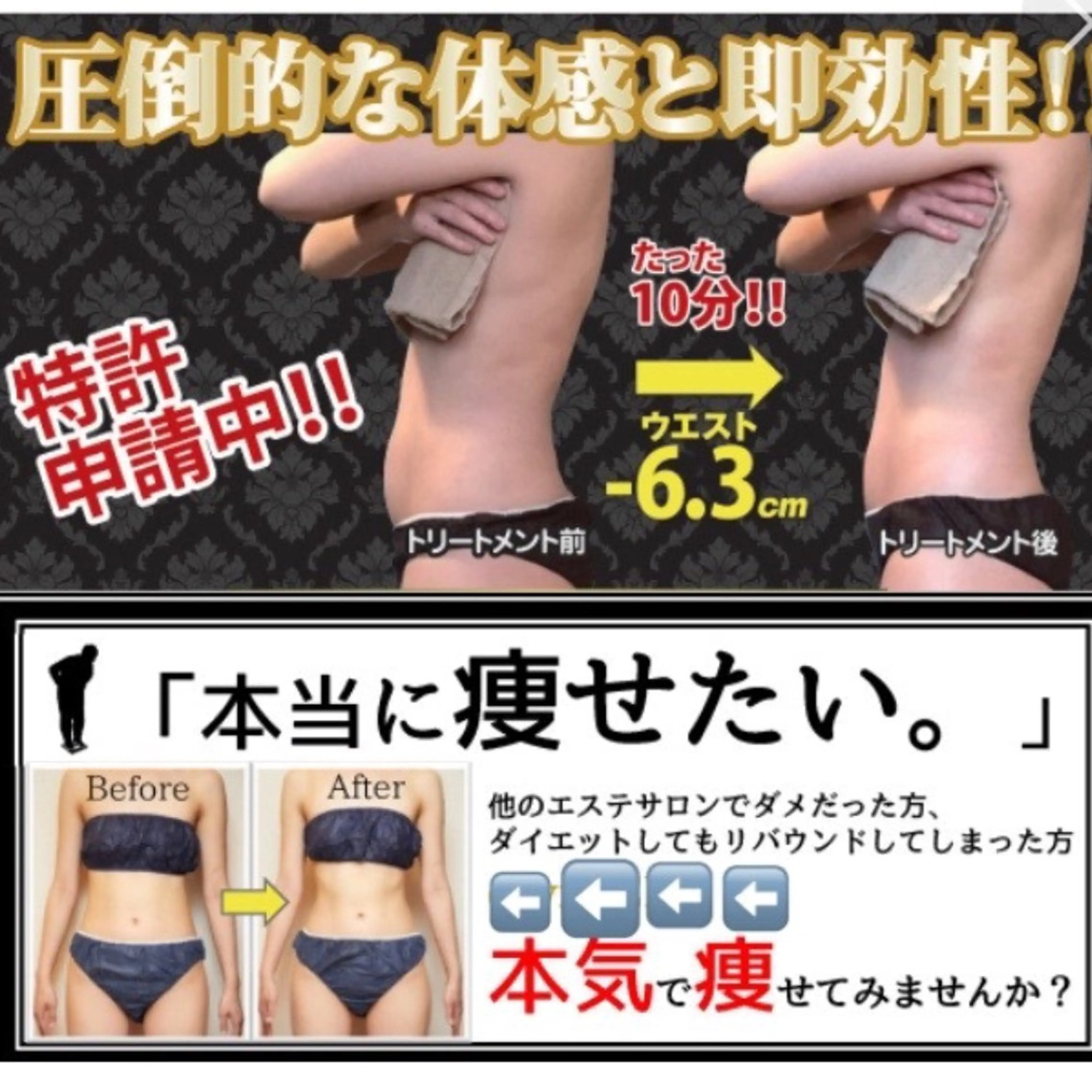 【結果重視の痩身！お好きな部位をお選び下さい】特許取得のハイレベルなマシンで結果を出します！の写真