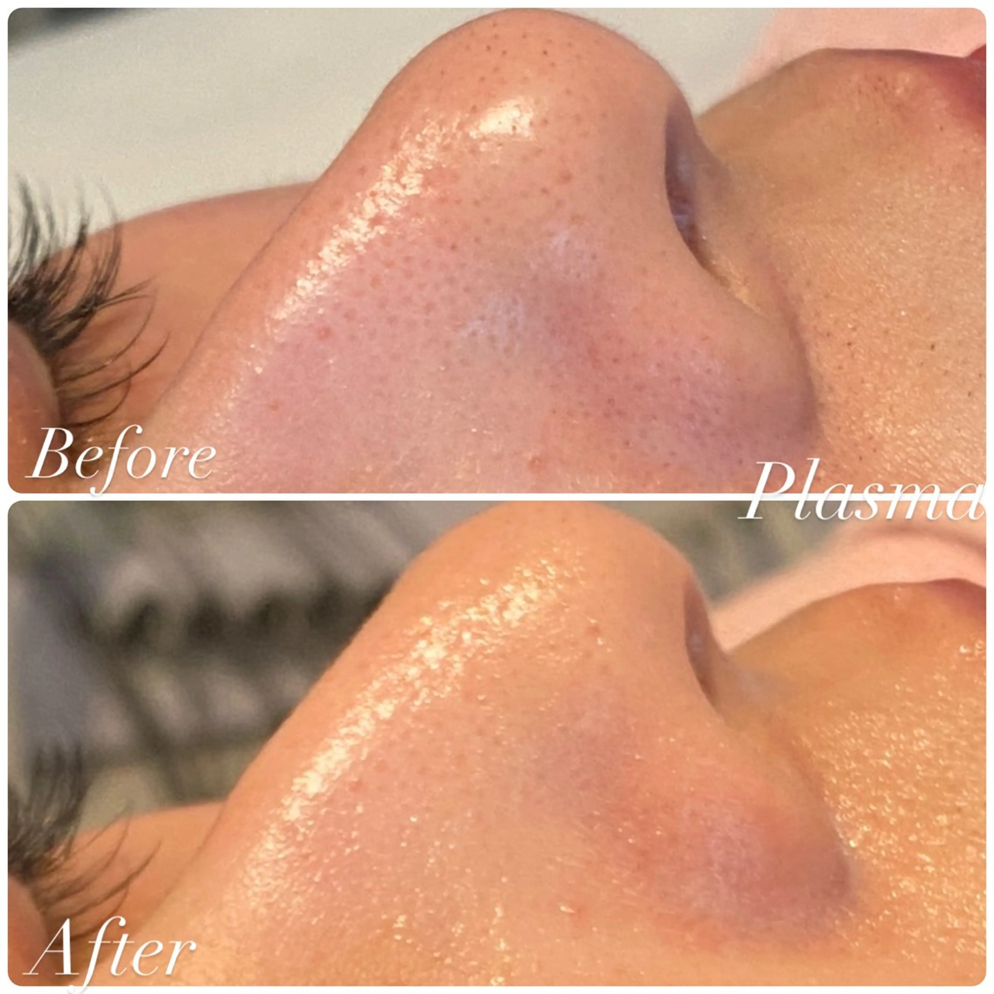 エステ 綺麗のひみつ グランプリ受賞店のエステ・リラクイメージ