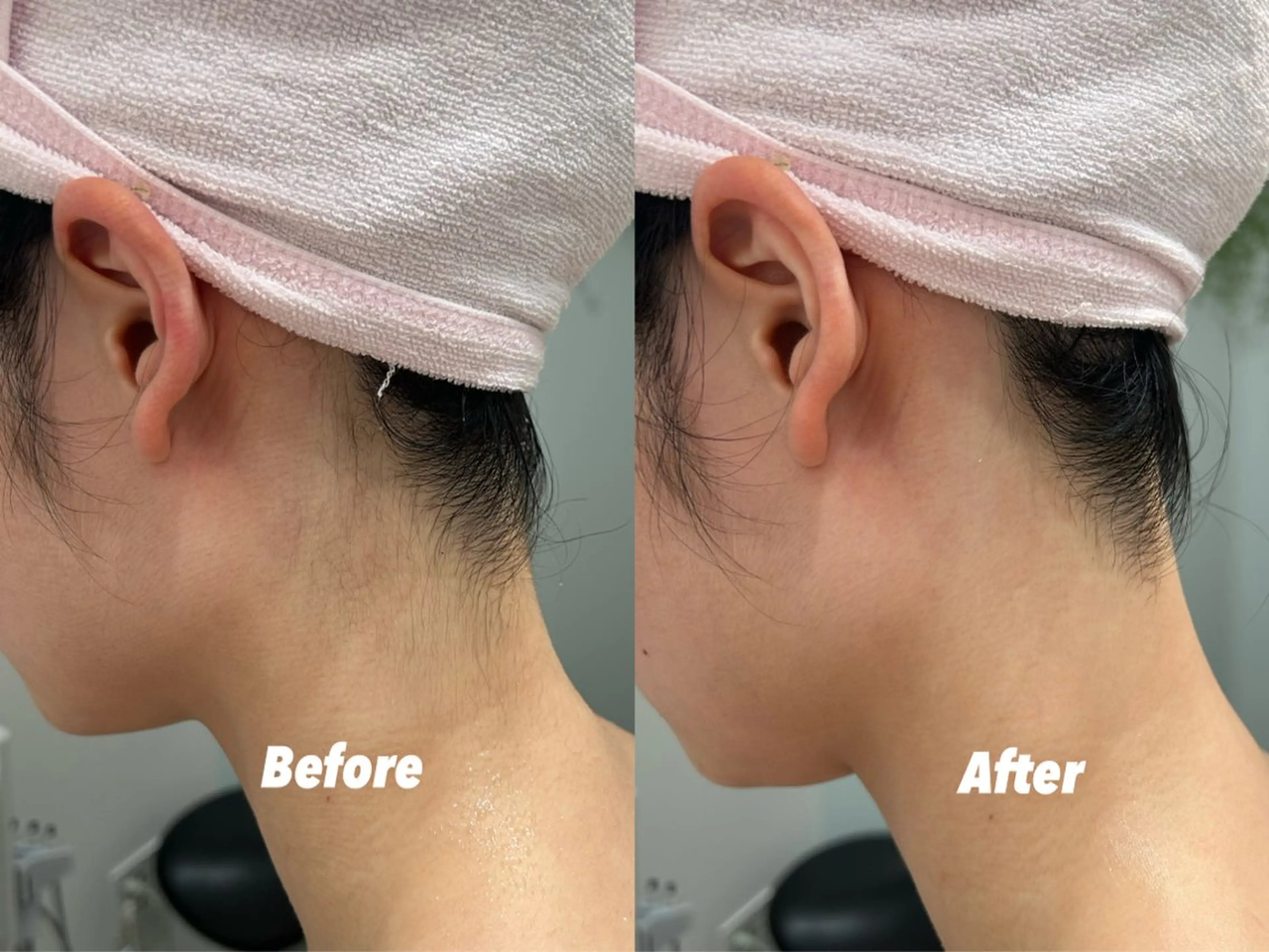 その他 🫧美しい素肌へ🫧 今成柚乃のその他イメージ