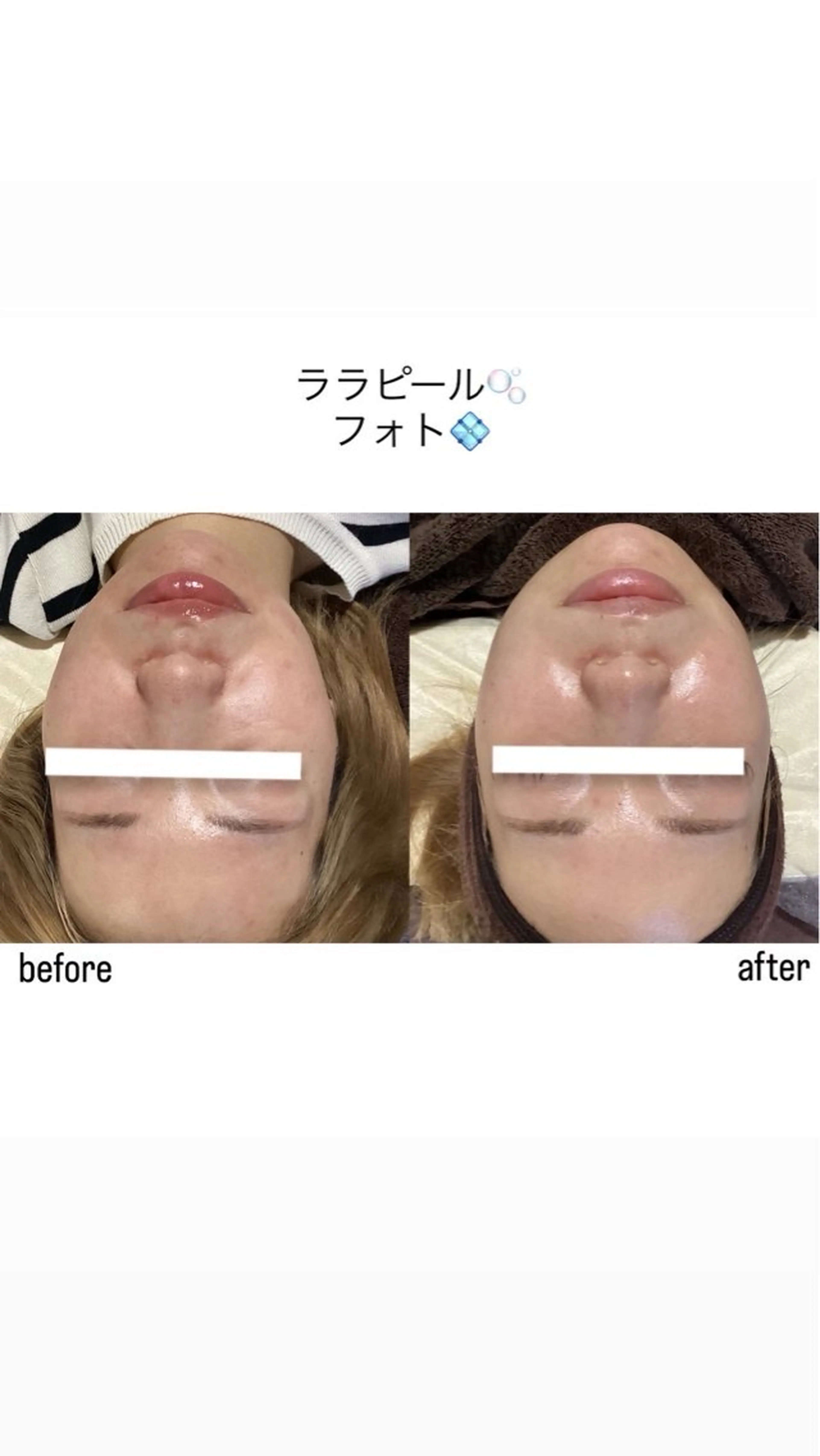 salon merci和泉のエステ・リラクイメージ