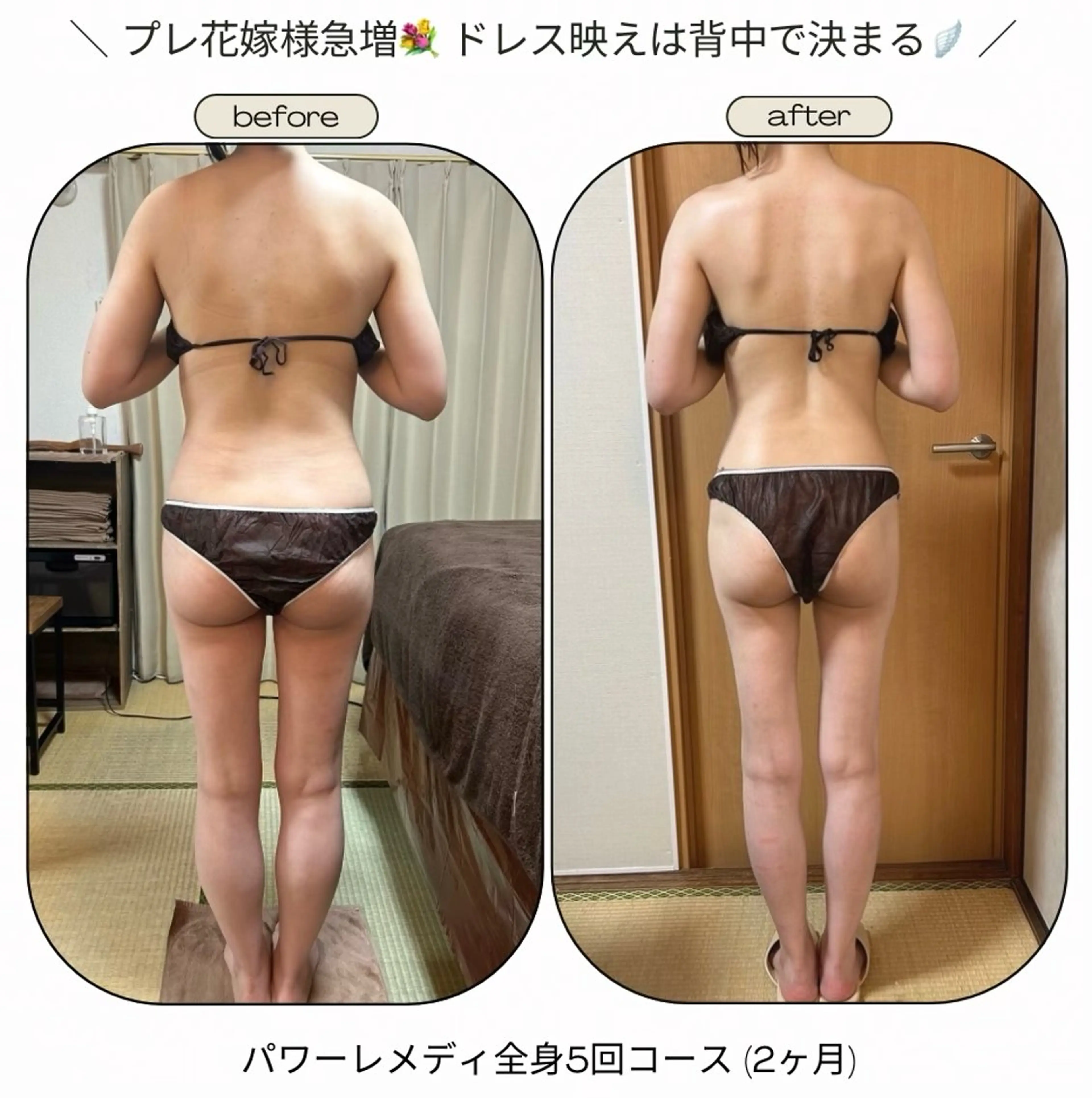 エステ リラク biloop所属・《痩身×疲労改善》 BILOOPのエステ・リラクイメージ