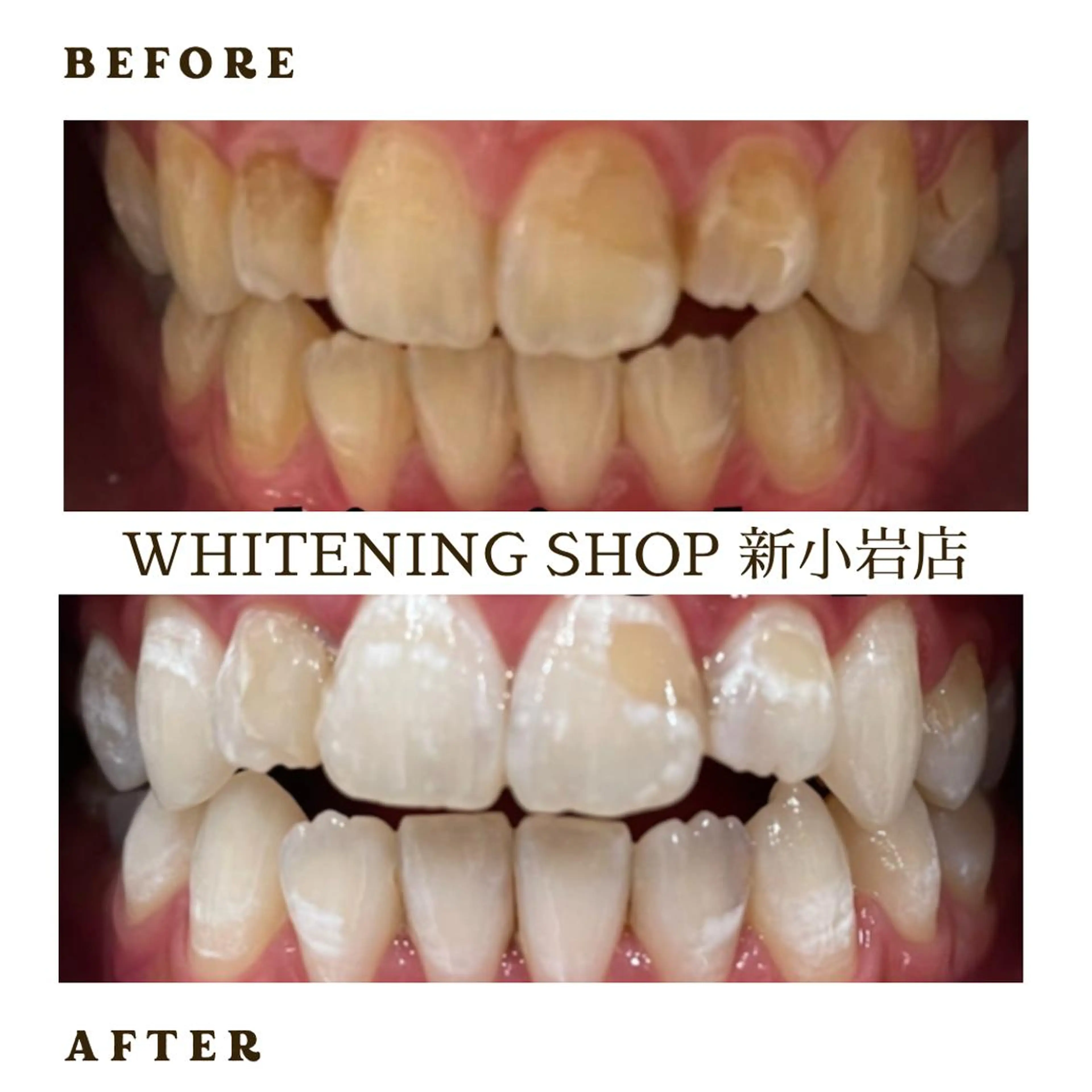 メンズ その他 ホワイトニング ショップ新小岩店のその他イメージ
