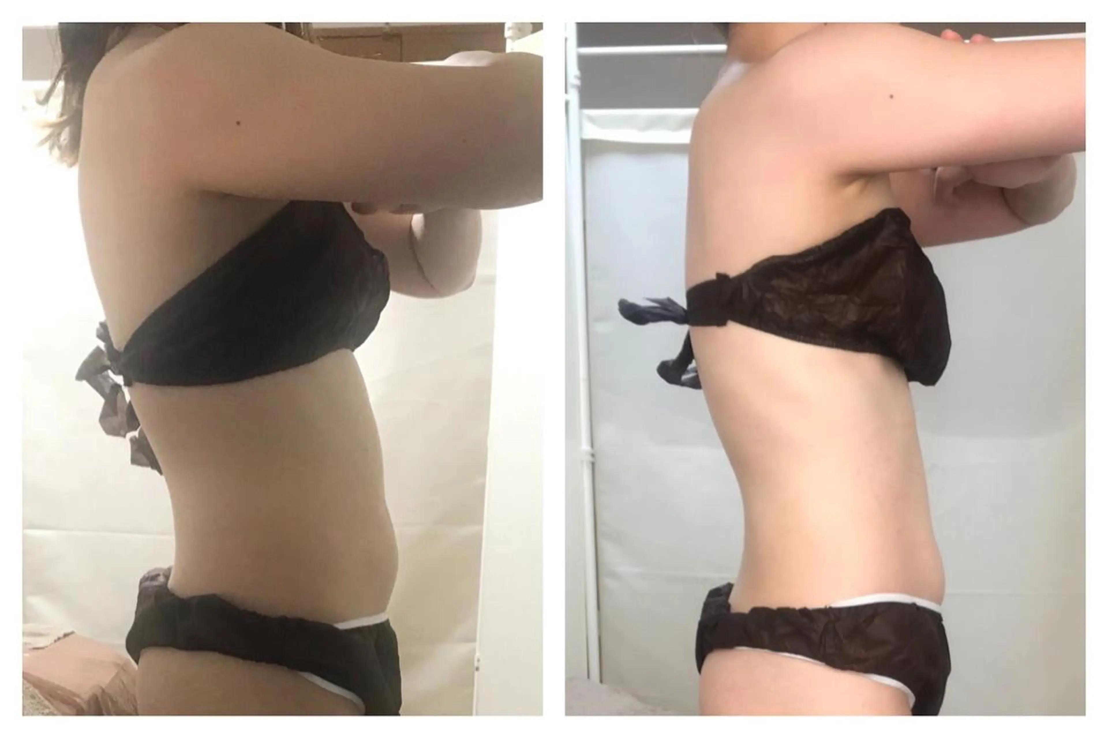 biloop所属・《痩身×疲労改善》 BILOOPのエステ・リラクイメージ