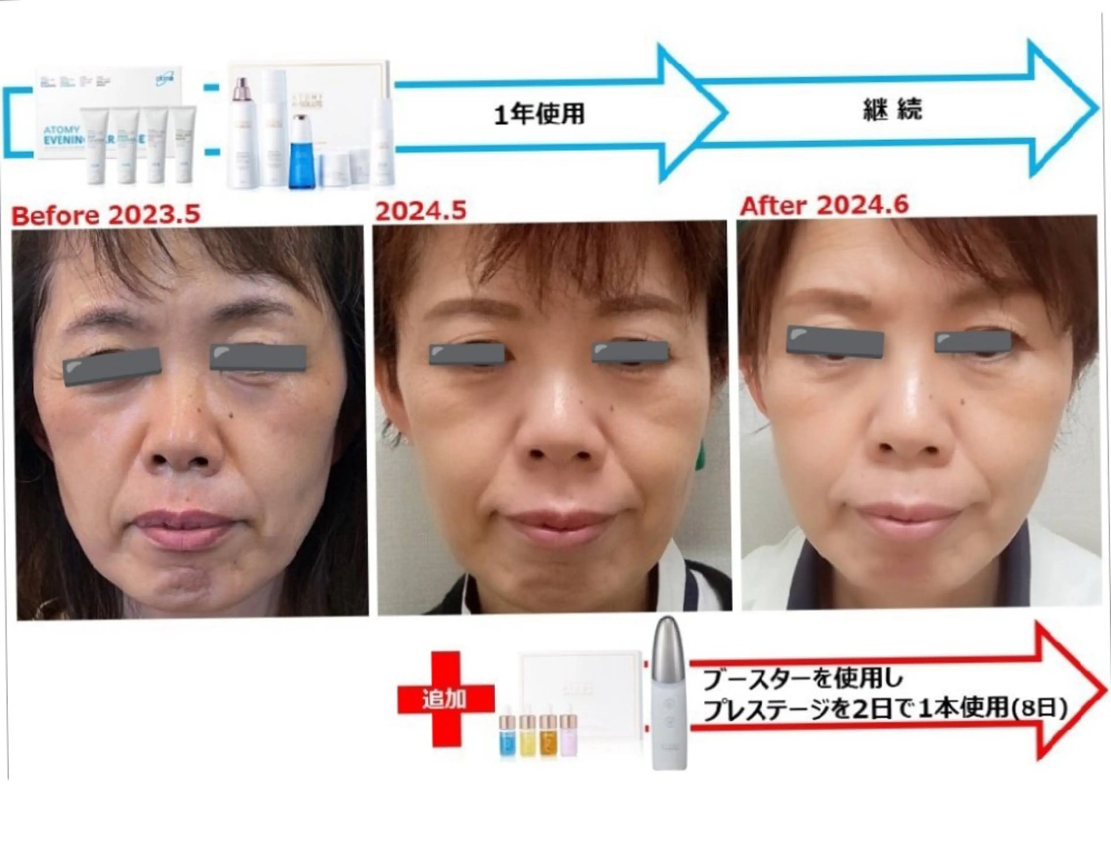 集中美容液導入コース(開封した4種はお持ち帰り)の写真