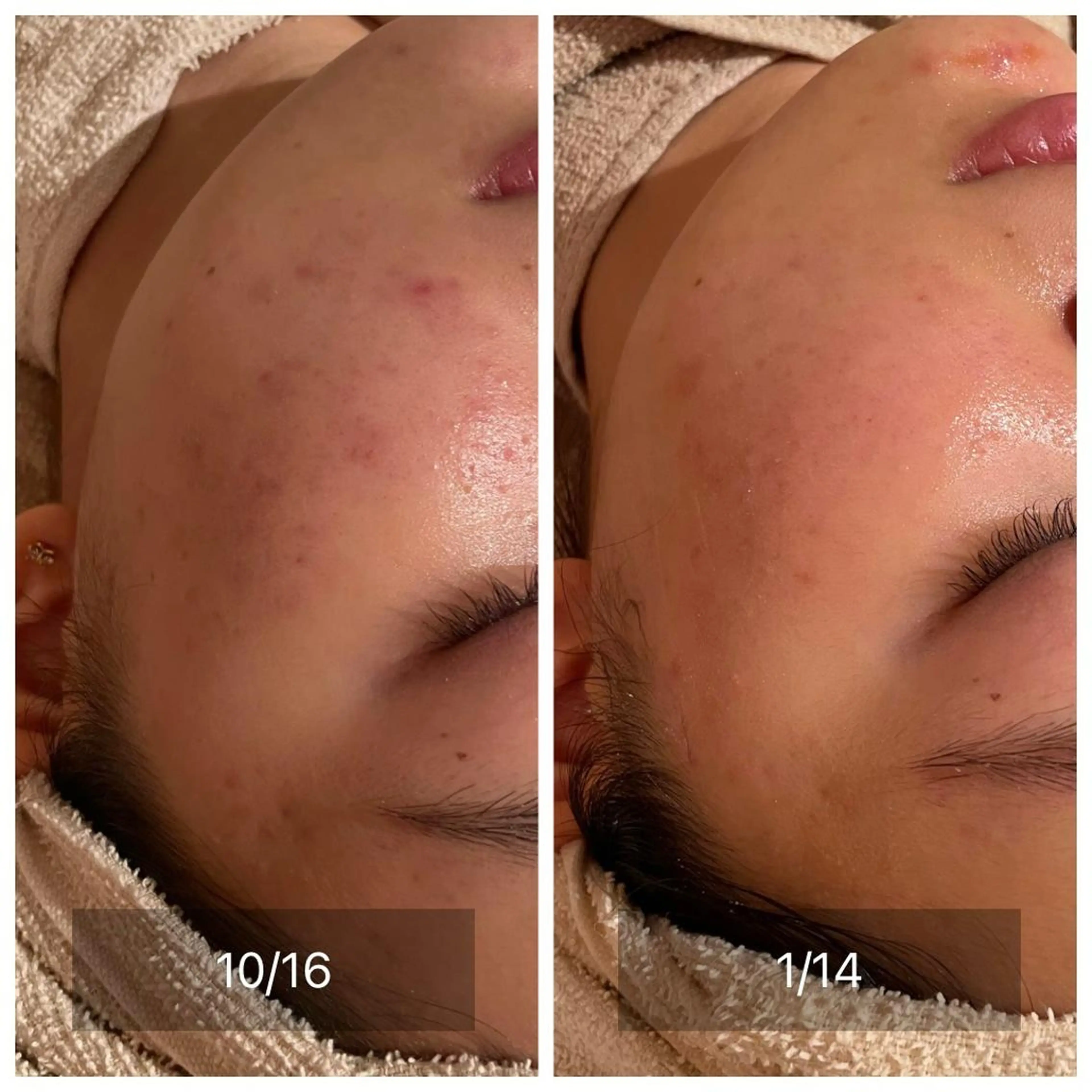 CHERIE所属・CHERIE Hisadaのエステ・リラクイメージ