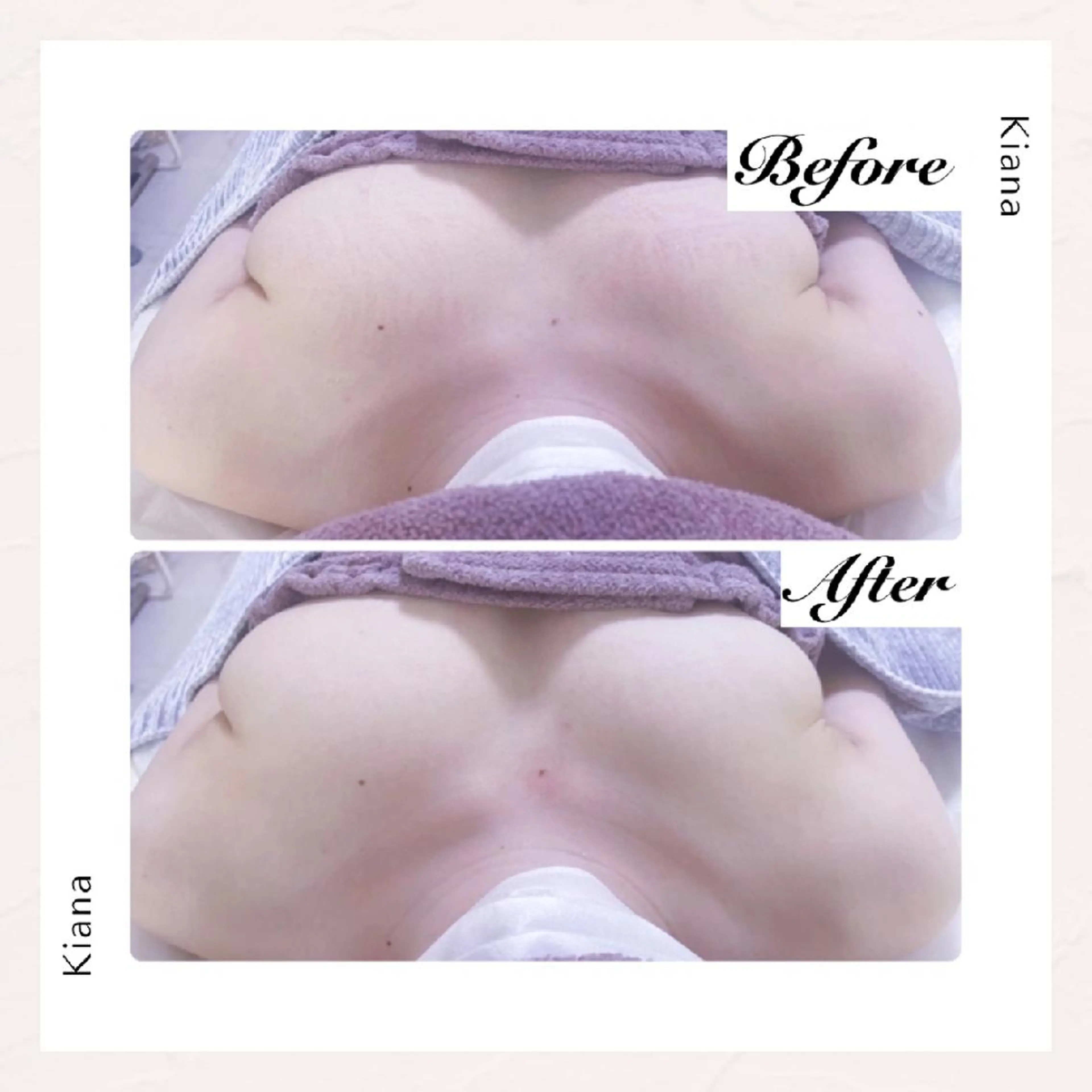 【バスト専門店 】 Kiana のエステ・リラクイメージ