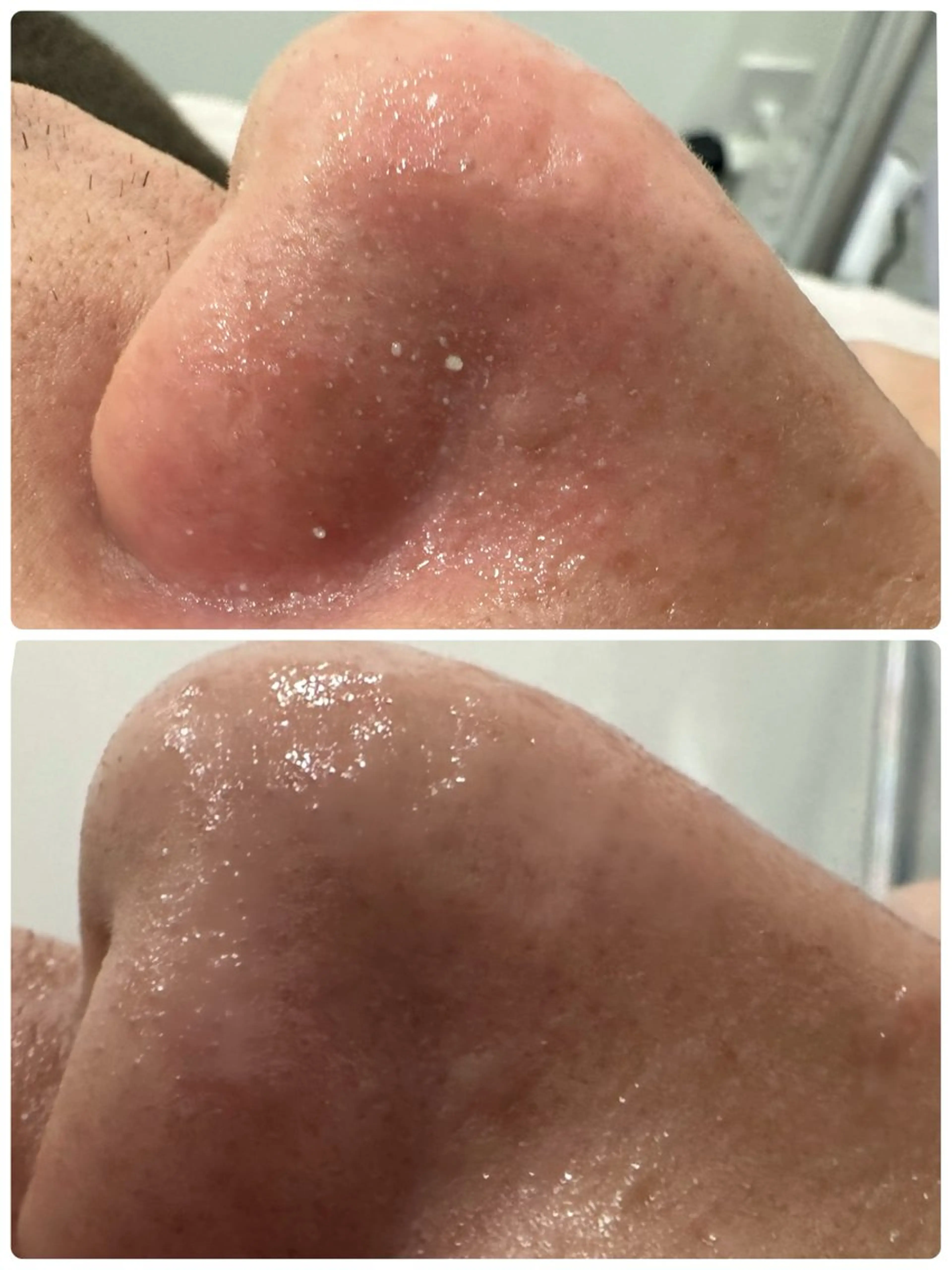 NAVI 韓国肌管理所属・NAVI韓国肌管理《 毛穴/艶肌/小顔》のエステ・リラクイメージ