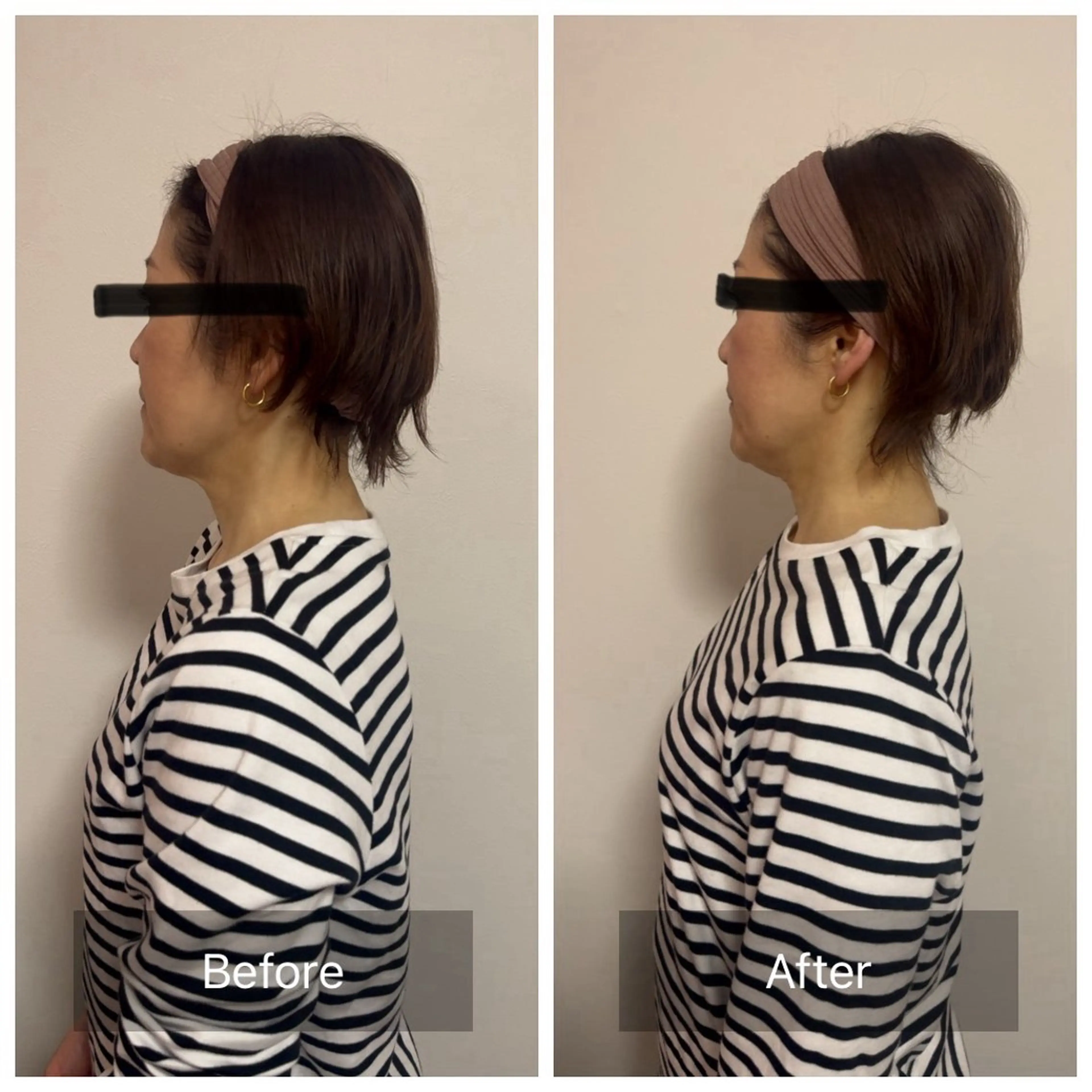 Ocouture所属・Ocouture ホワイトニング、小顔のその他イメージ