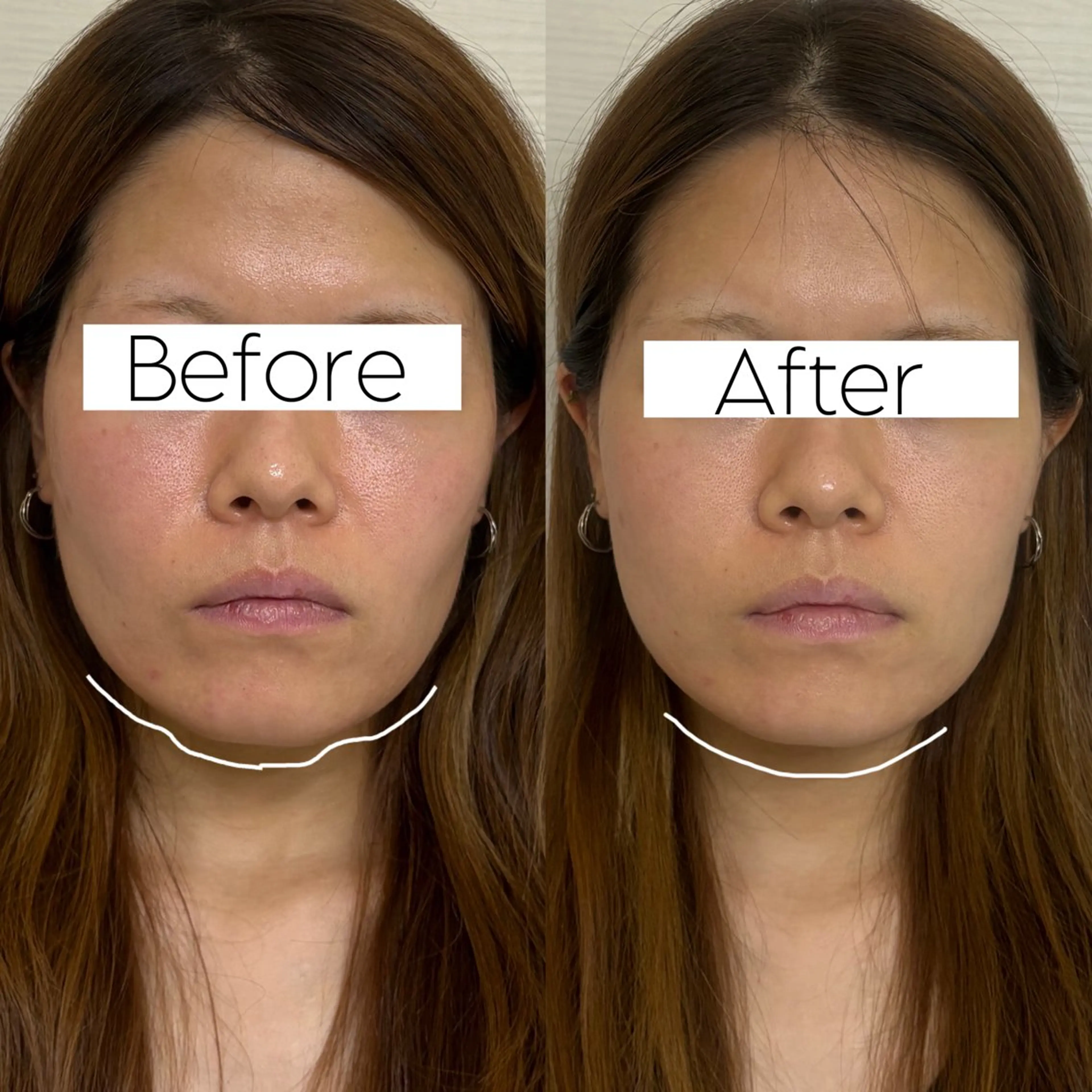 Private salon La.所属・Stellum 小顔矯正&ヘッドスパのエステ・リラクイメージ