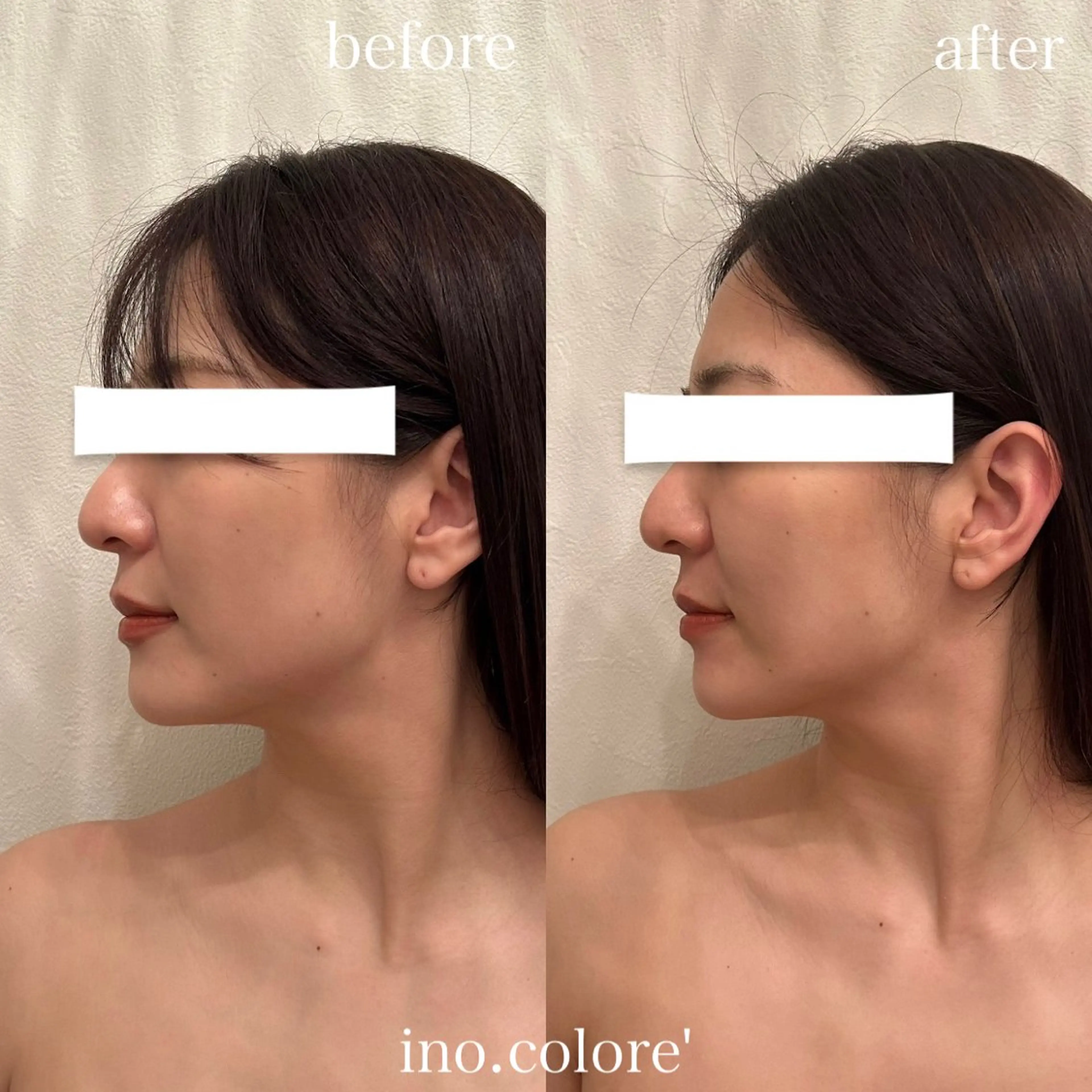 エステサロンino.colore'所属・小顔サロン ino.coloreのエステ・リラクイメージ