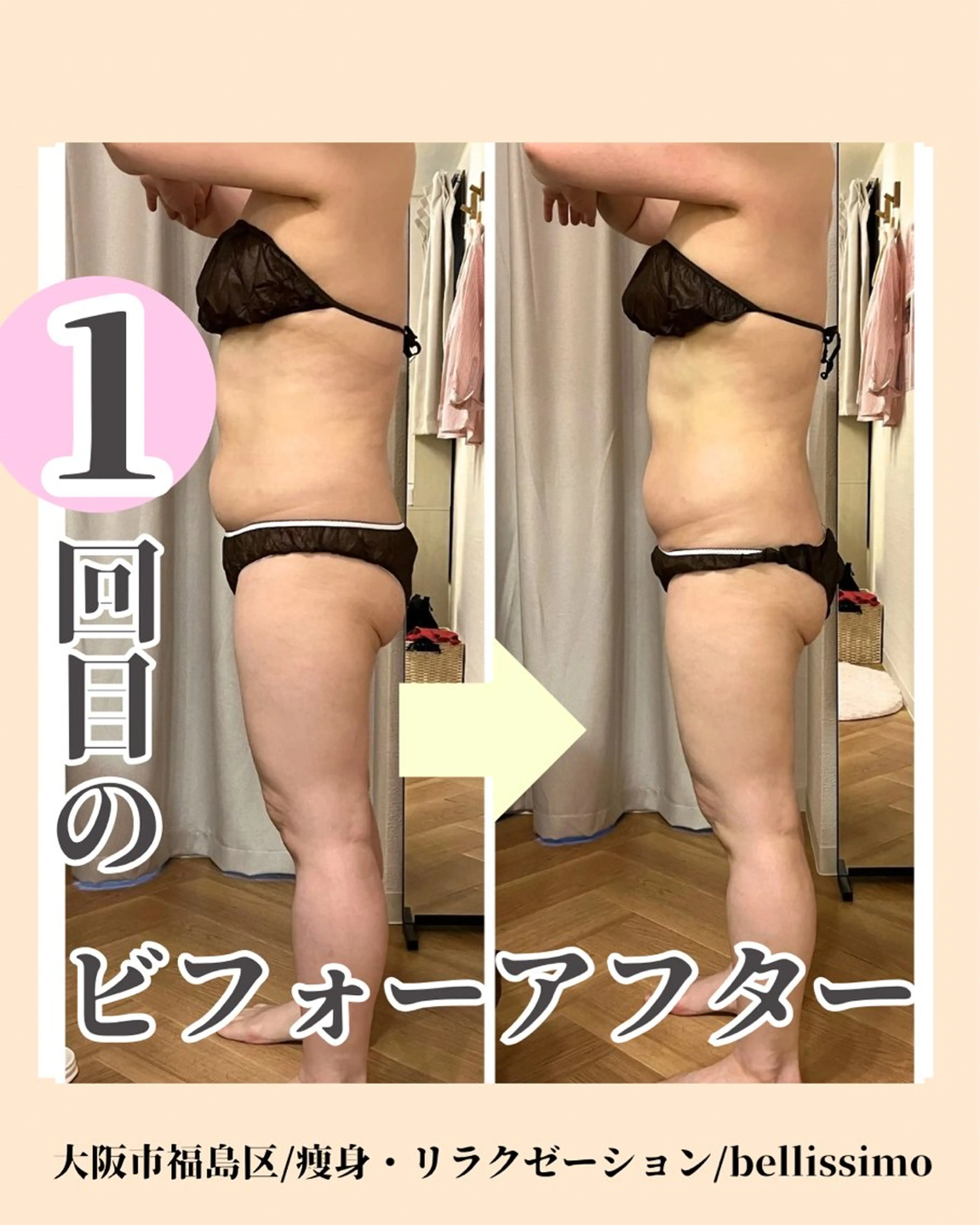 bellissimo 【ベリッシモ】所属・ちひろ　痩身/ハーブ bellissimoのエステ・リラクイメージ