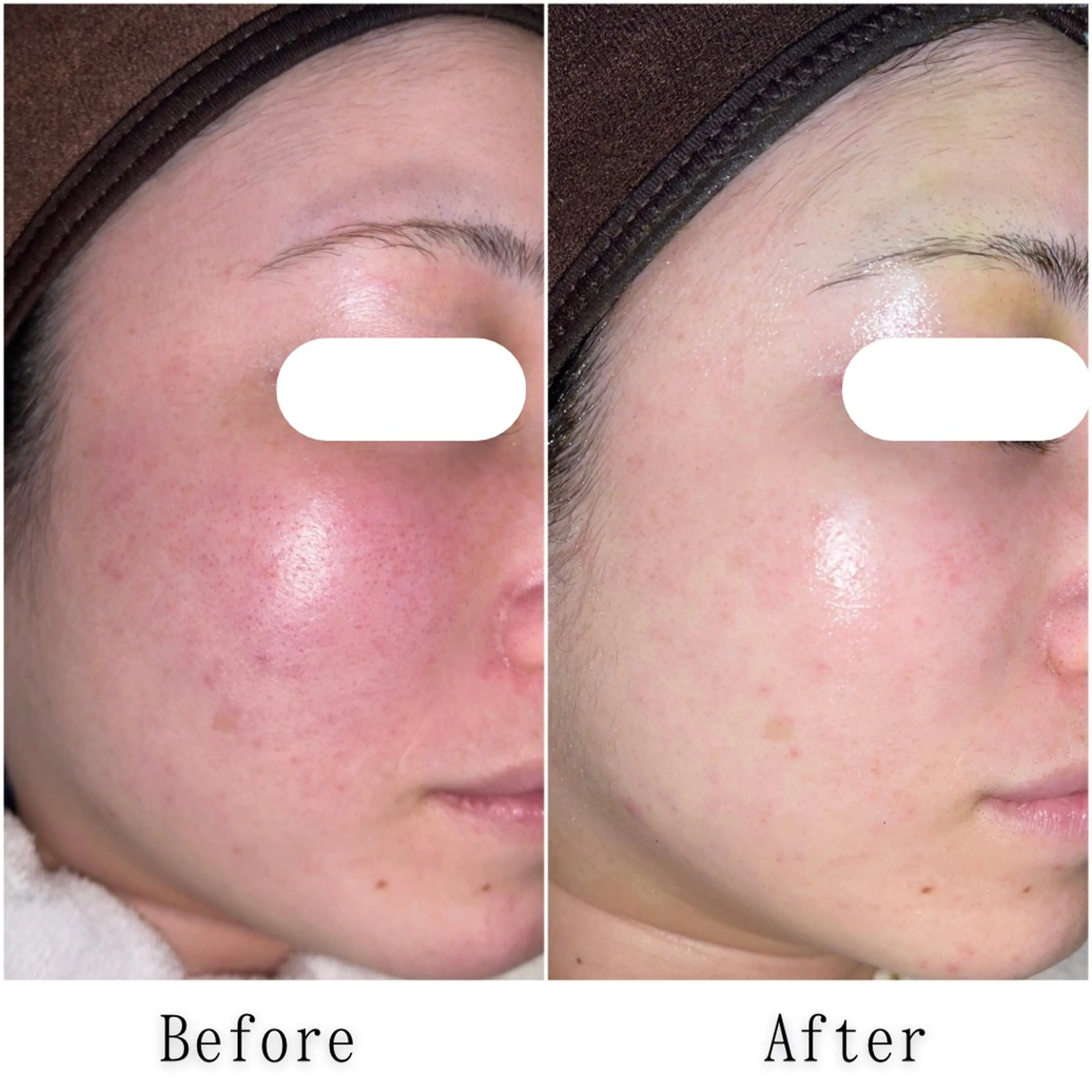 その他 SELF  BEAUTY gracia浦添店所属・gracia 浦添店のその他イメージ