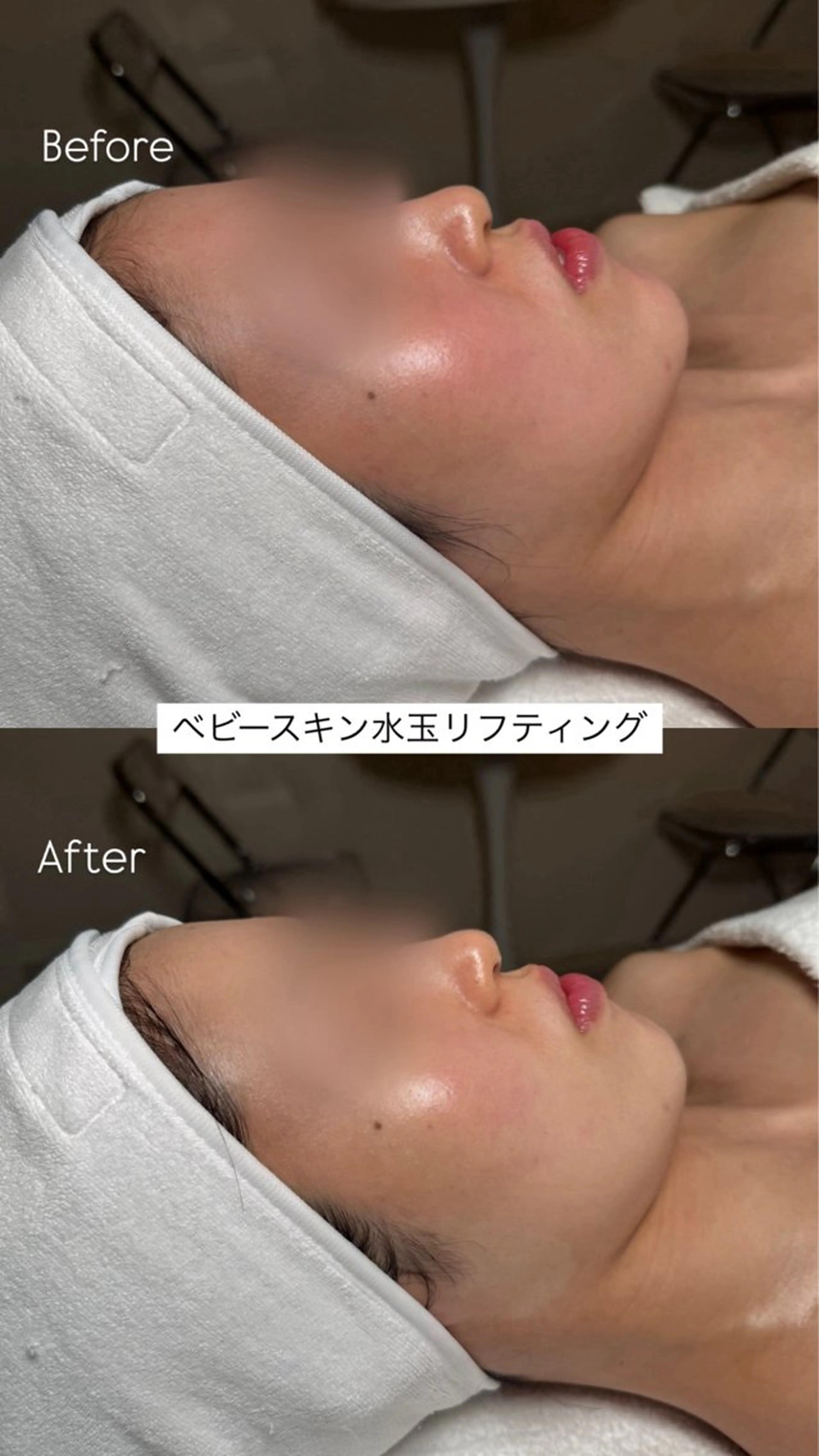 韓国肌管理🫧LDM 🫧Junnaのエステ・リラクイメージ