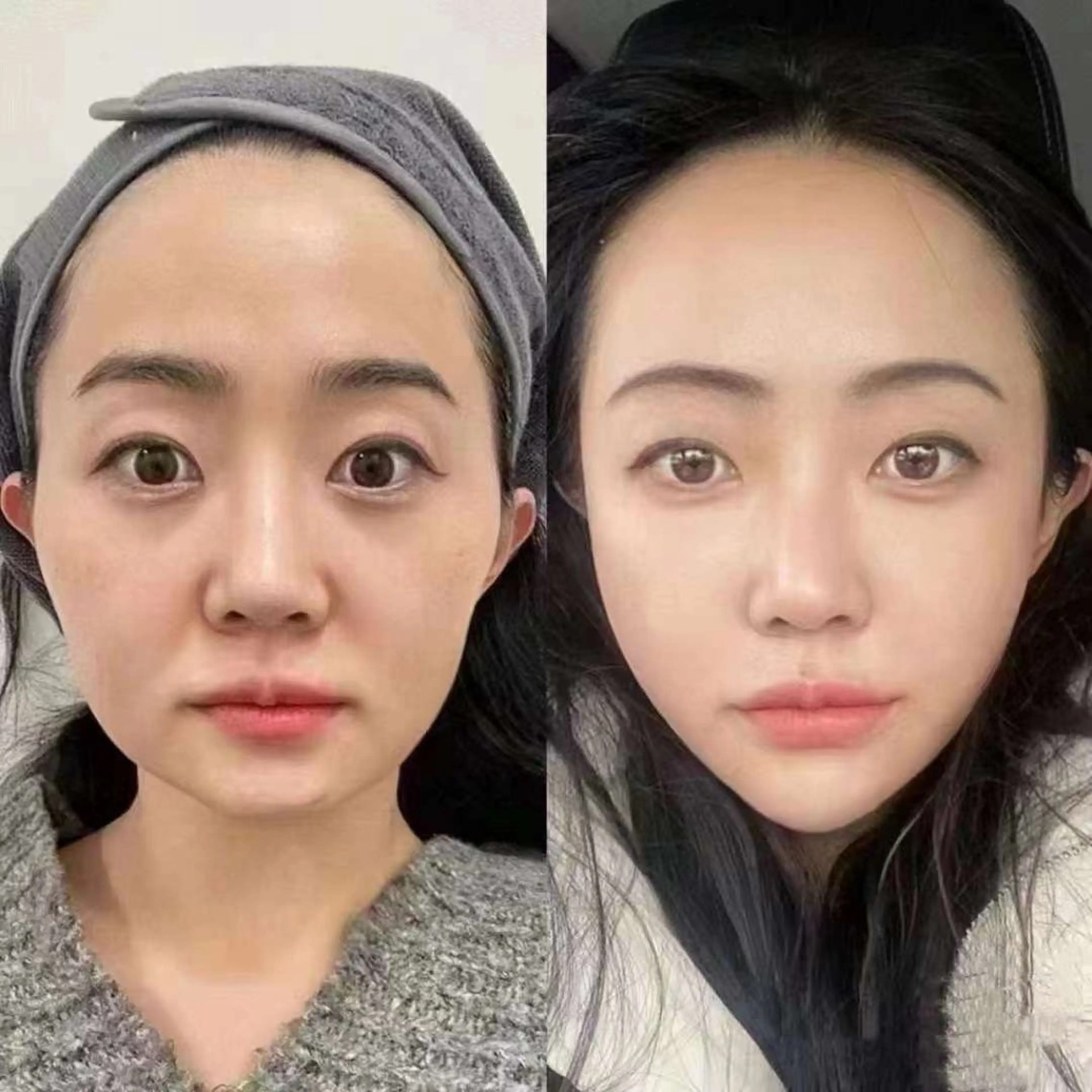 ネイル ブライダルネイル ホワイト エステ aliaハイフ&水光ジェットサロン所属・aliaハーブ水光店 エステティシャン募集のエステ・リラクイメージ