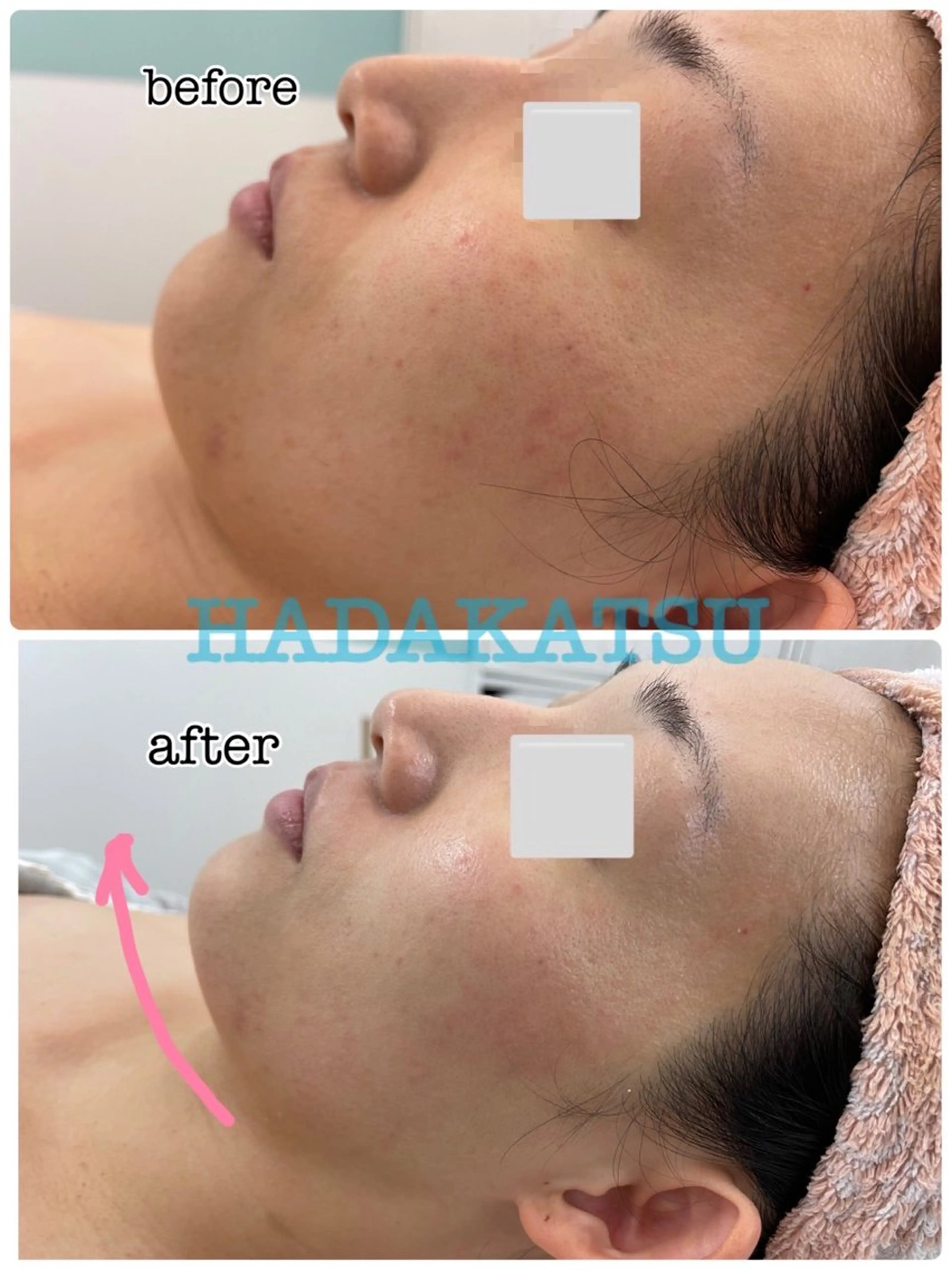 エステ 総合エステサロン 肌活のエステ・リラクイメージ