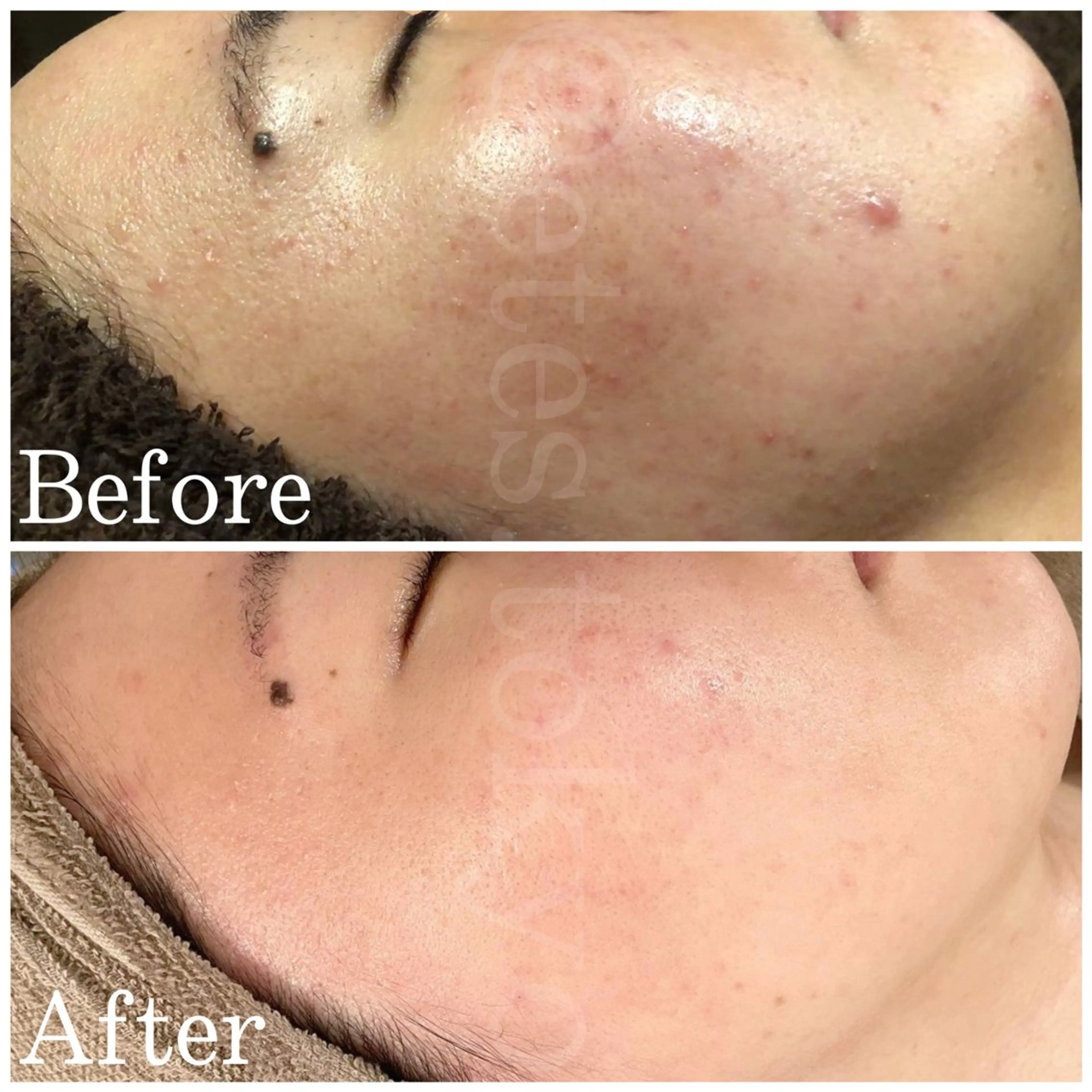 etes （エトエス）所属・etes.tokyo 中目黒のエステ・リラクイメージ