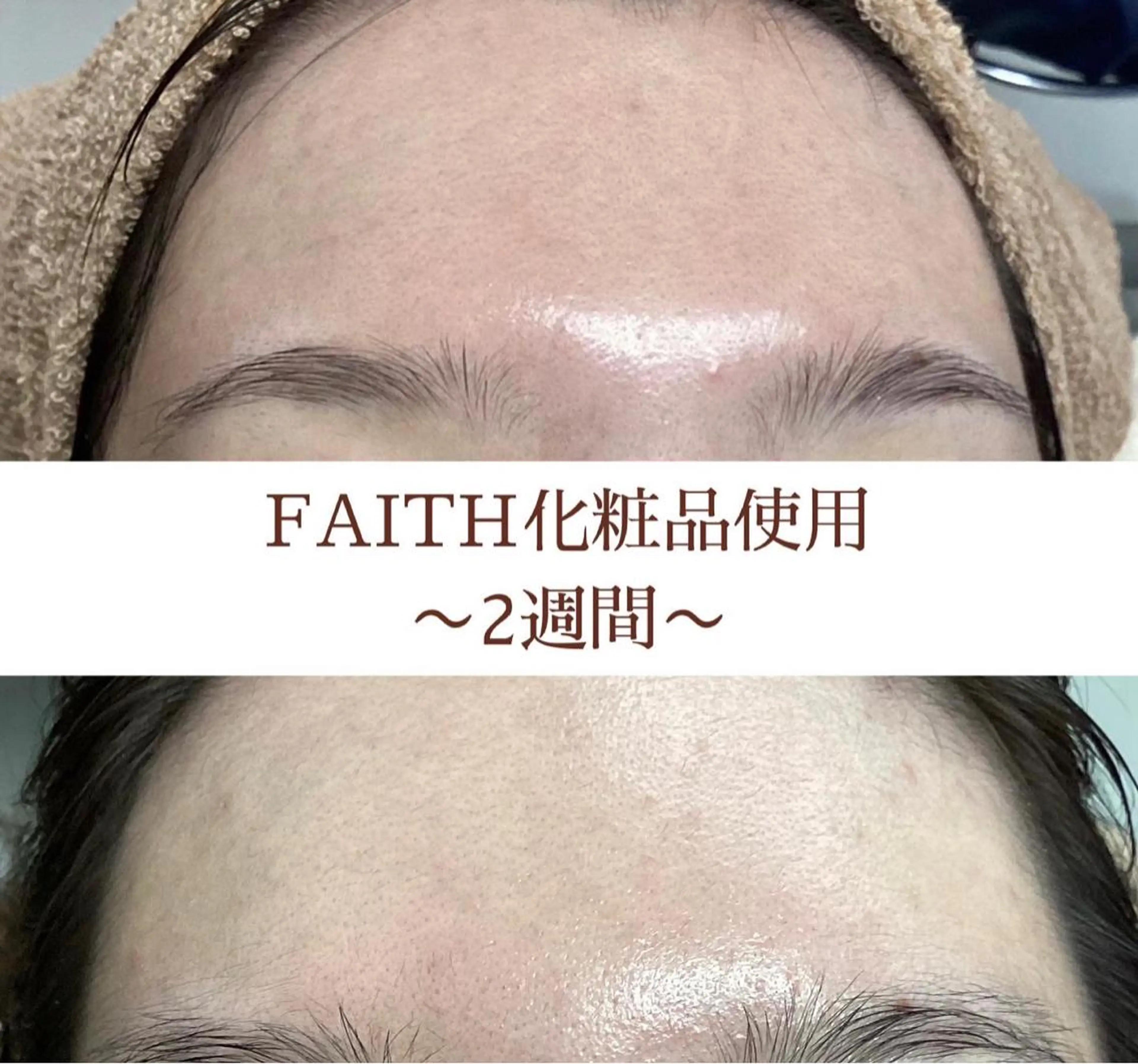 都度払い 肌質改善専門サロンのエステ・リラクイメージ